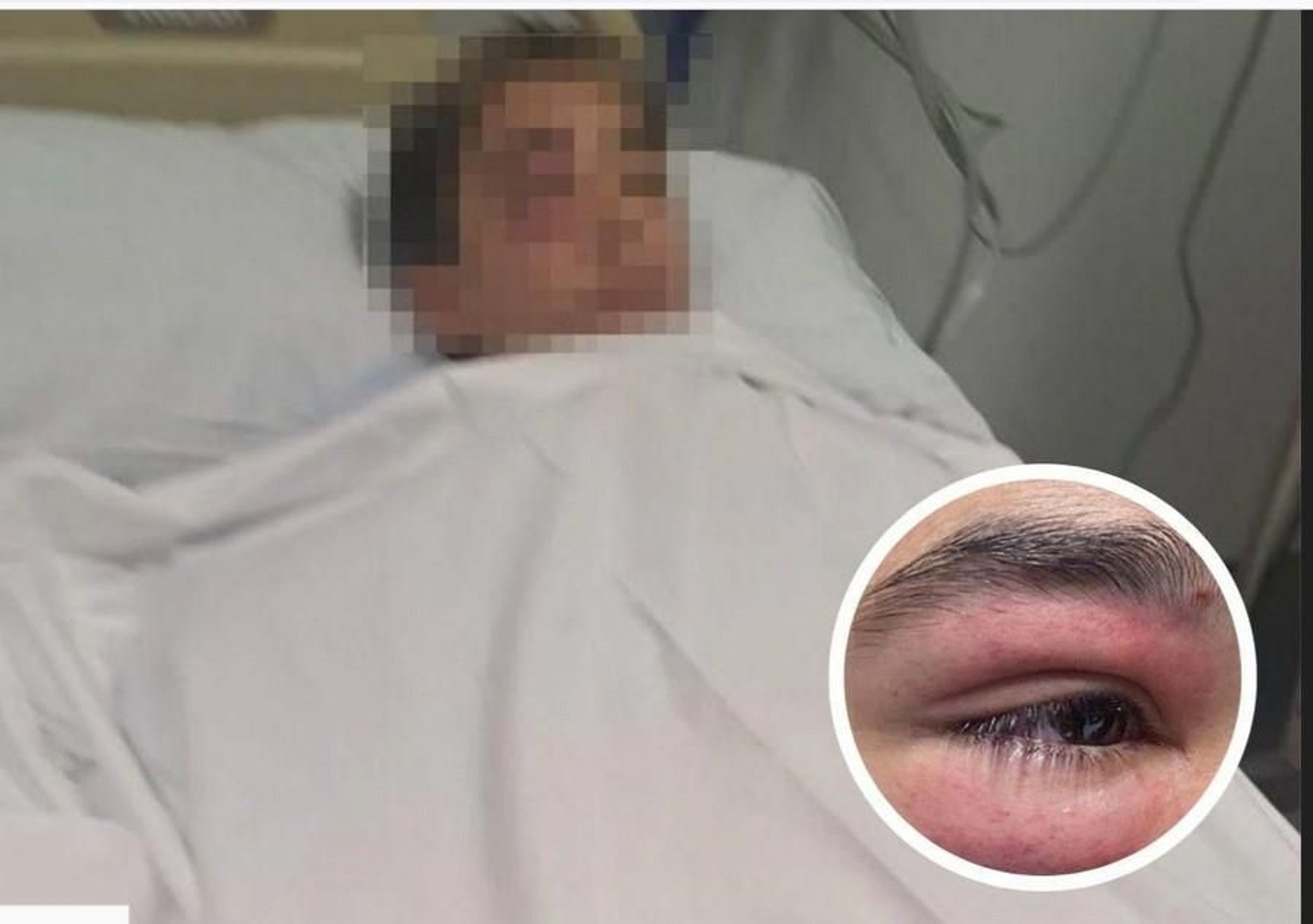 El menor agredido en el hospital y, en detalle, una de las heridas.