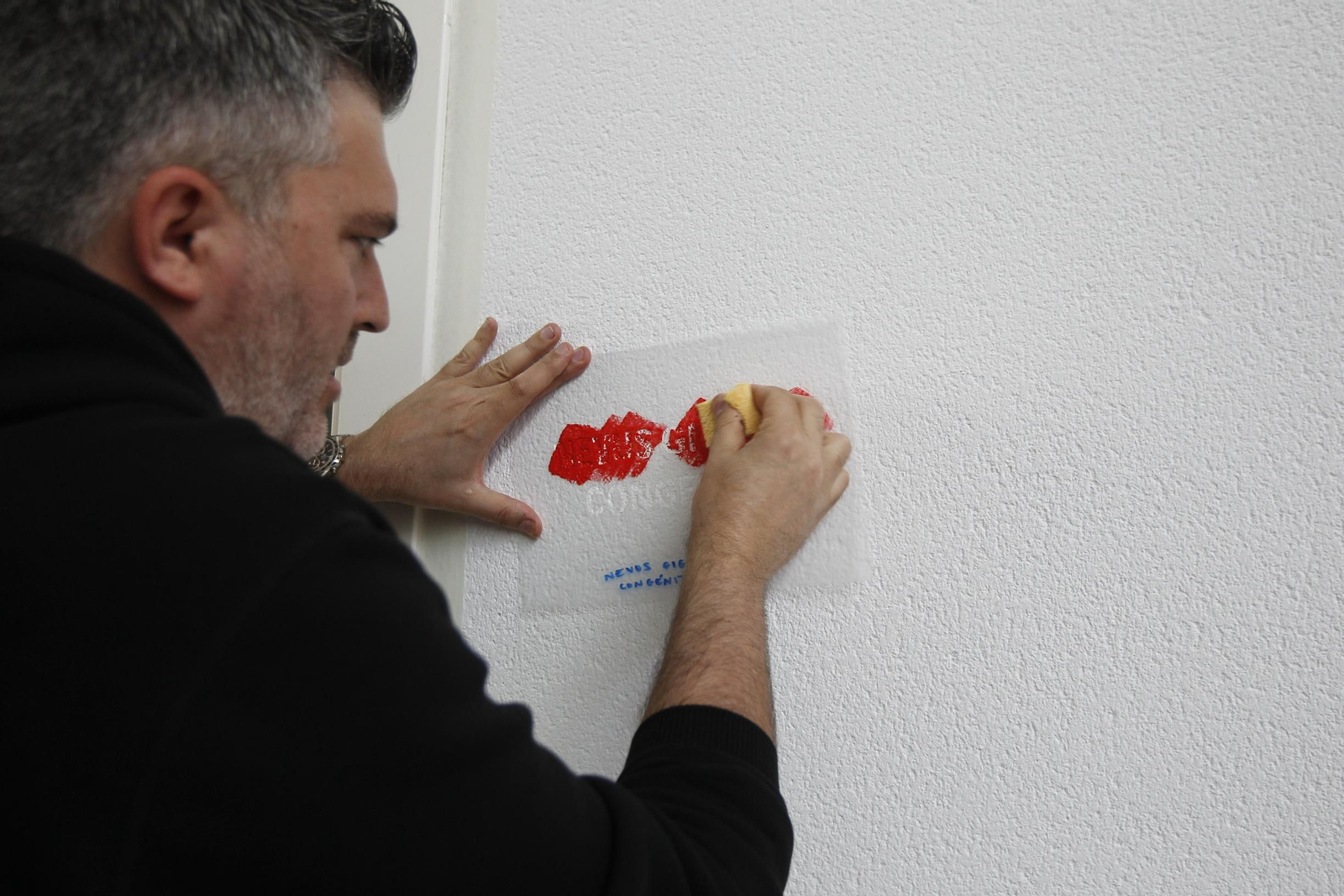 Fotos mural reivindicativo enfermedades raras Universidad de Almería-UAL