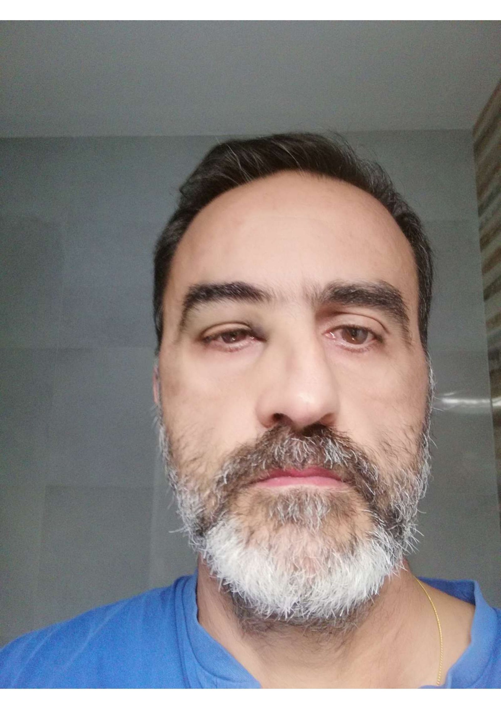 Así quedó la nariz de la víctima tras el puñetazo recibido