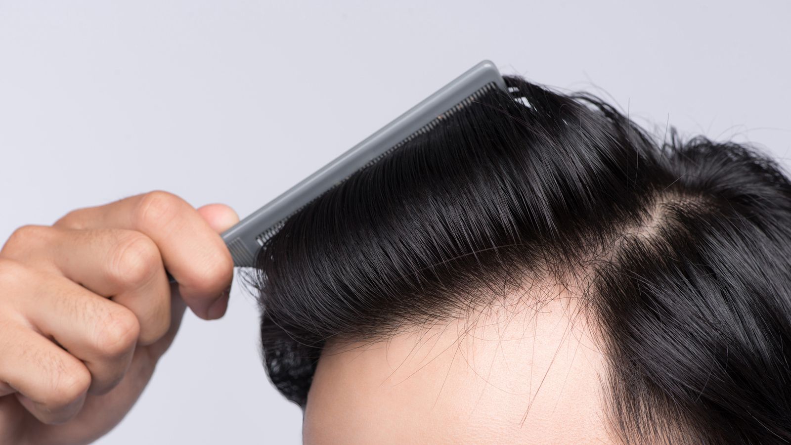 La Clínica HLASanta Isabelpone en marcha su nueva Unidad de Injerto Capilar