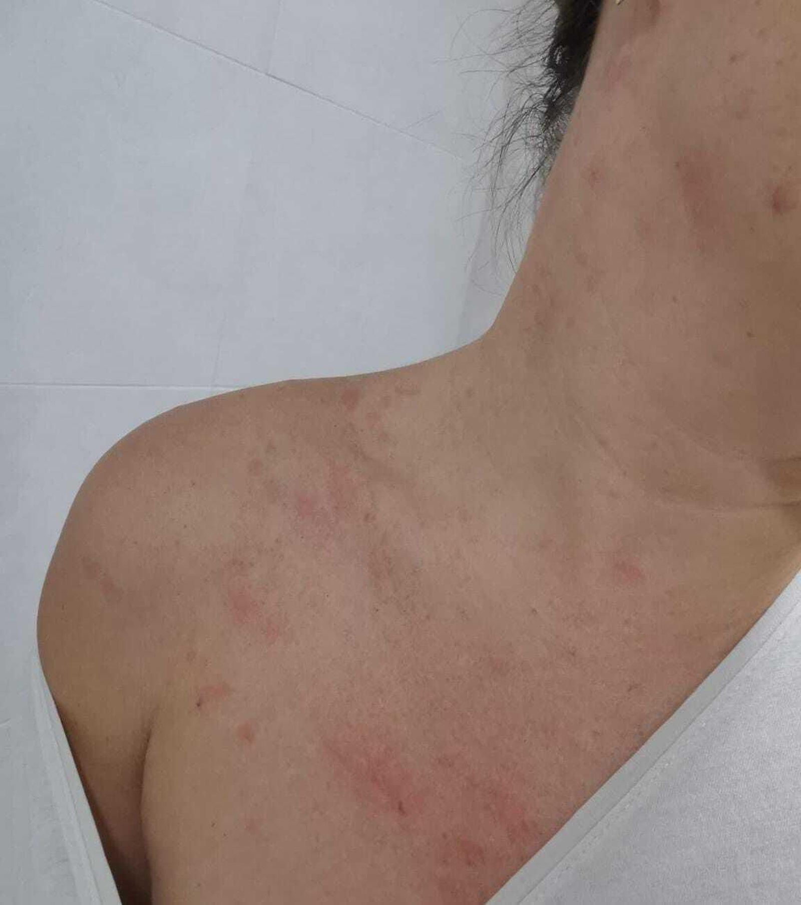 ¿Una plaga en el festival Interestelar de Sevilla?