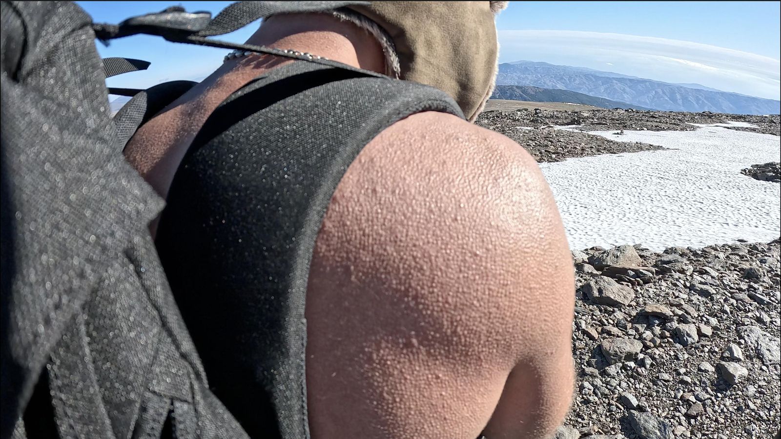 El aspecto de sus pieles con el frío.