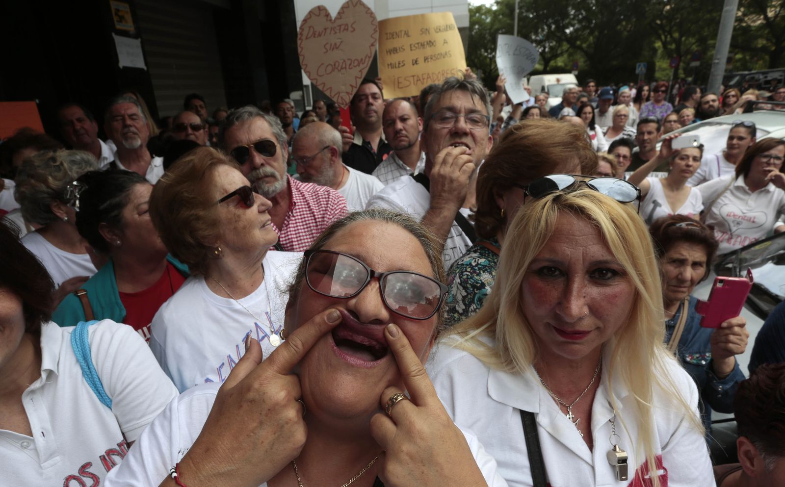 Una de las afectadas por el cierre de la clínica iDental de Sevilla muestra el estado de su boca.