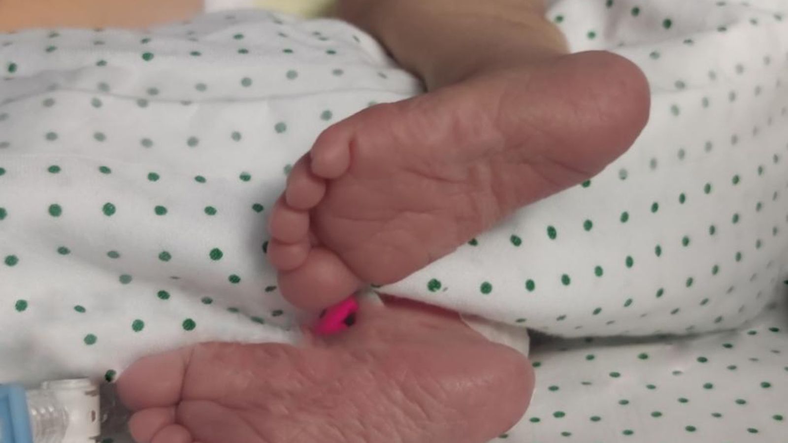 Imagen de los pies del recién nacido.