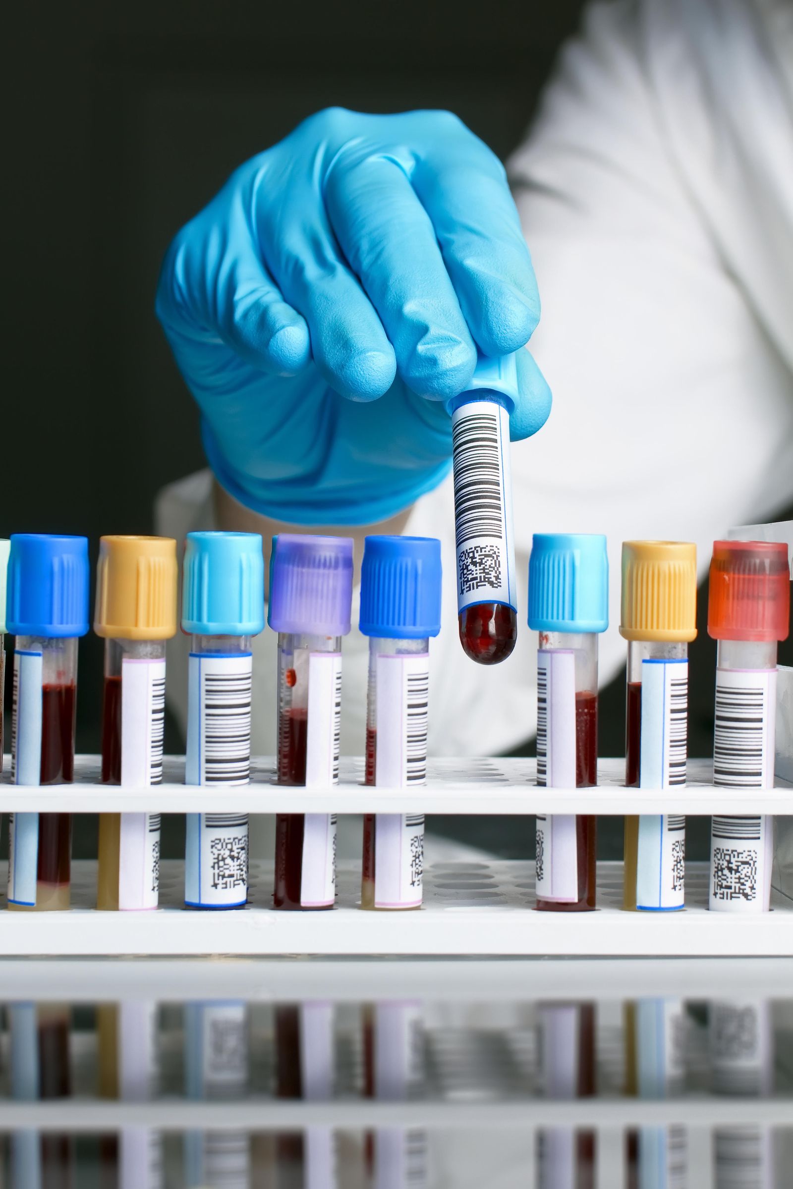 El efecto trombótico del Covid ha empujado la investigación en el área de trombosis y hemostasia.