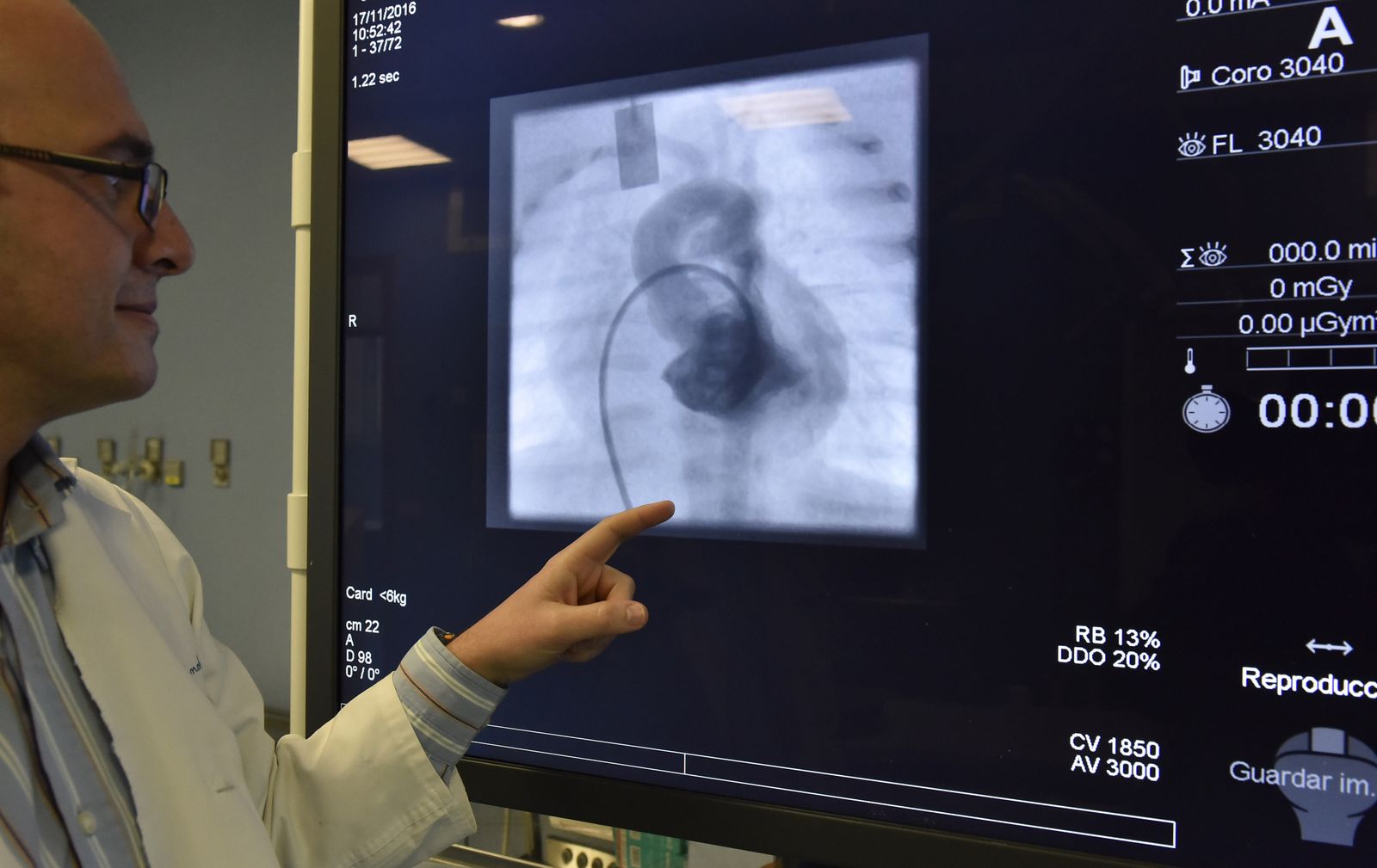 El doctor Félix Coserria muestra una imagen de un cateterismo,