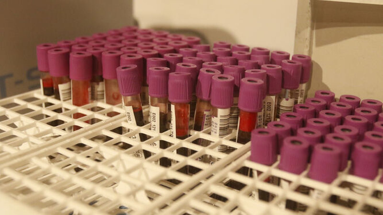 Una enzima transforma sangre del grupo A y B en cero negativo, universalmente compatible