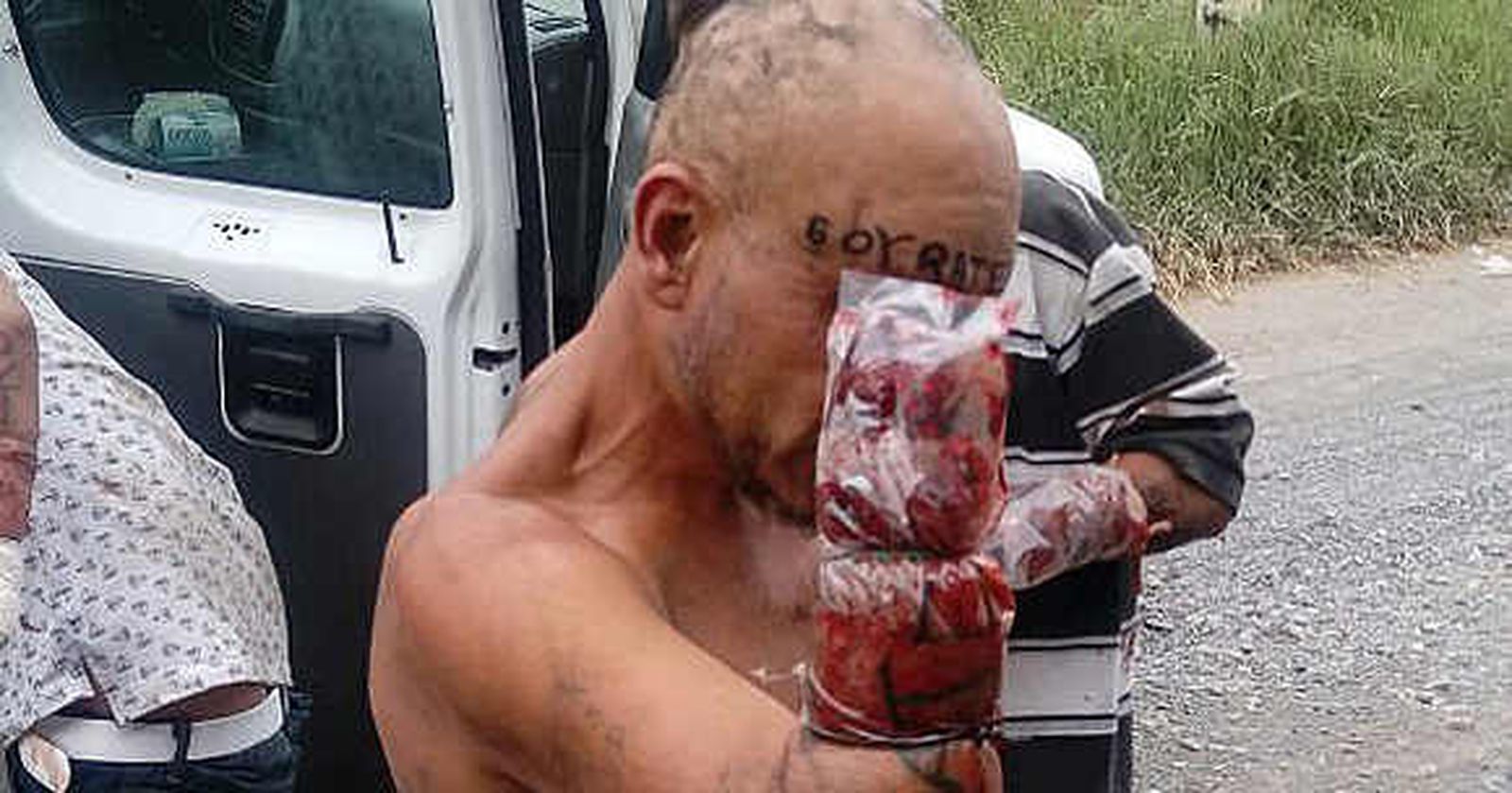 Amputan las manos a seis personas en México como "escarmiento" por una deuda de drogas