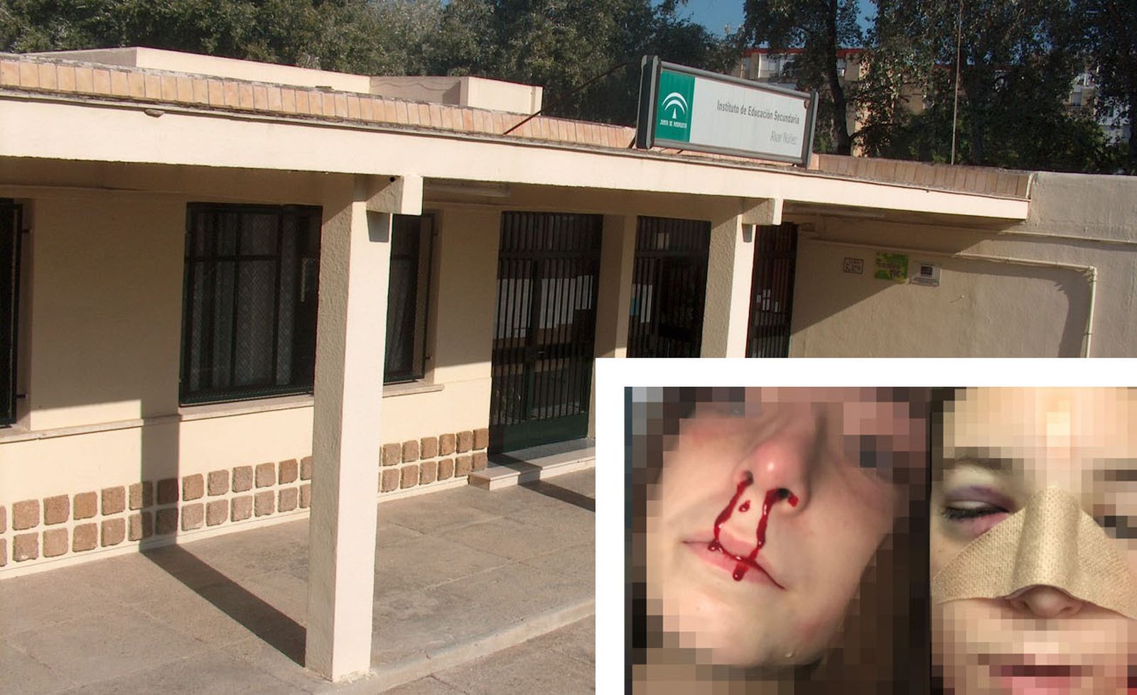 El instituto Álvar Núñez y en el recuadro las heridas que sufrió la niña agredida.