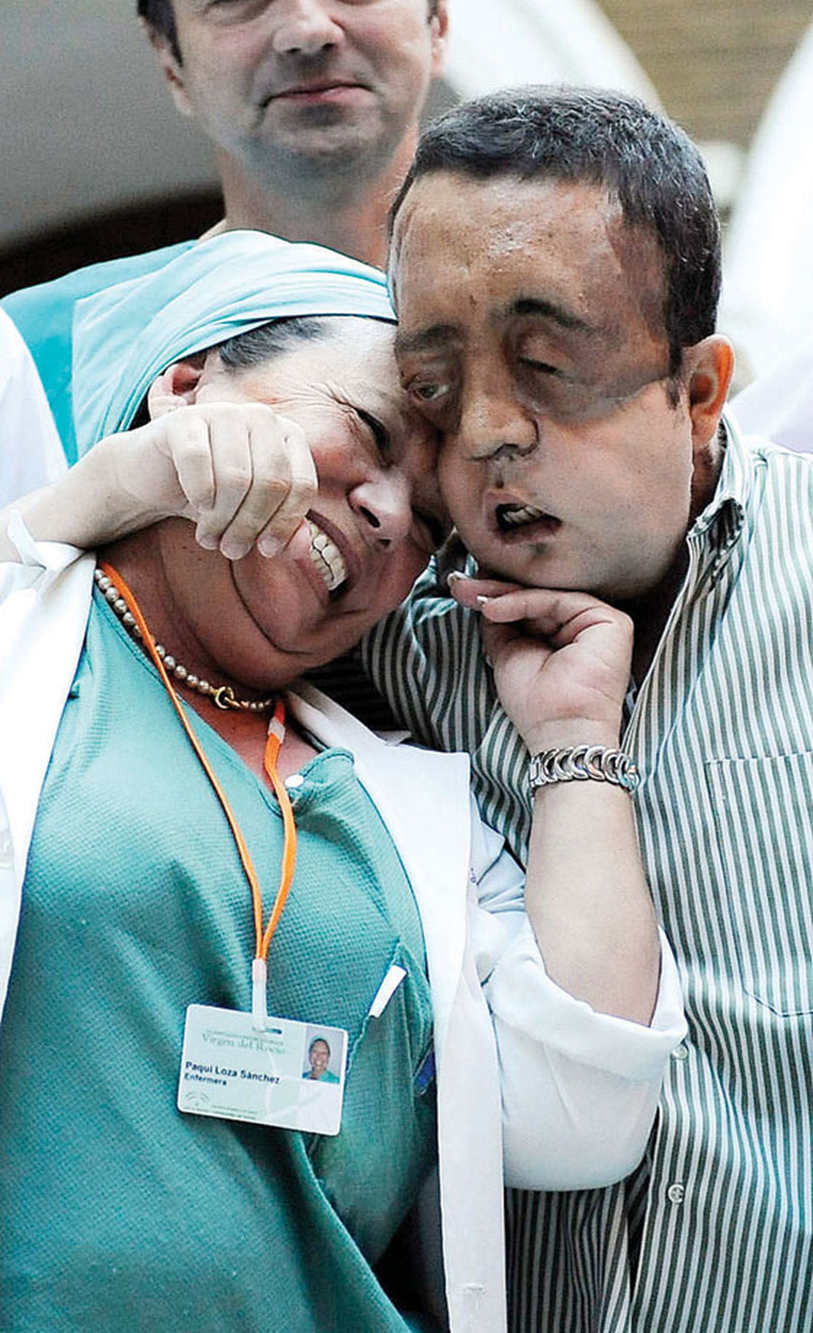 Transplante de cara en Andalucía