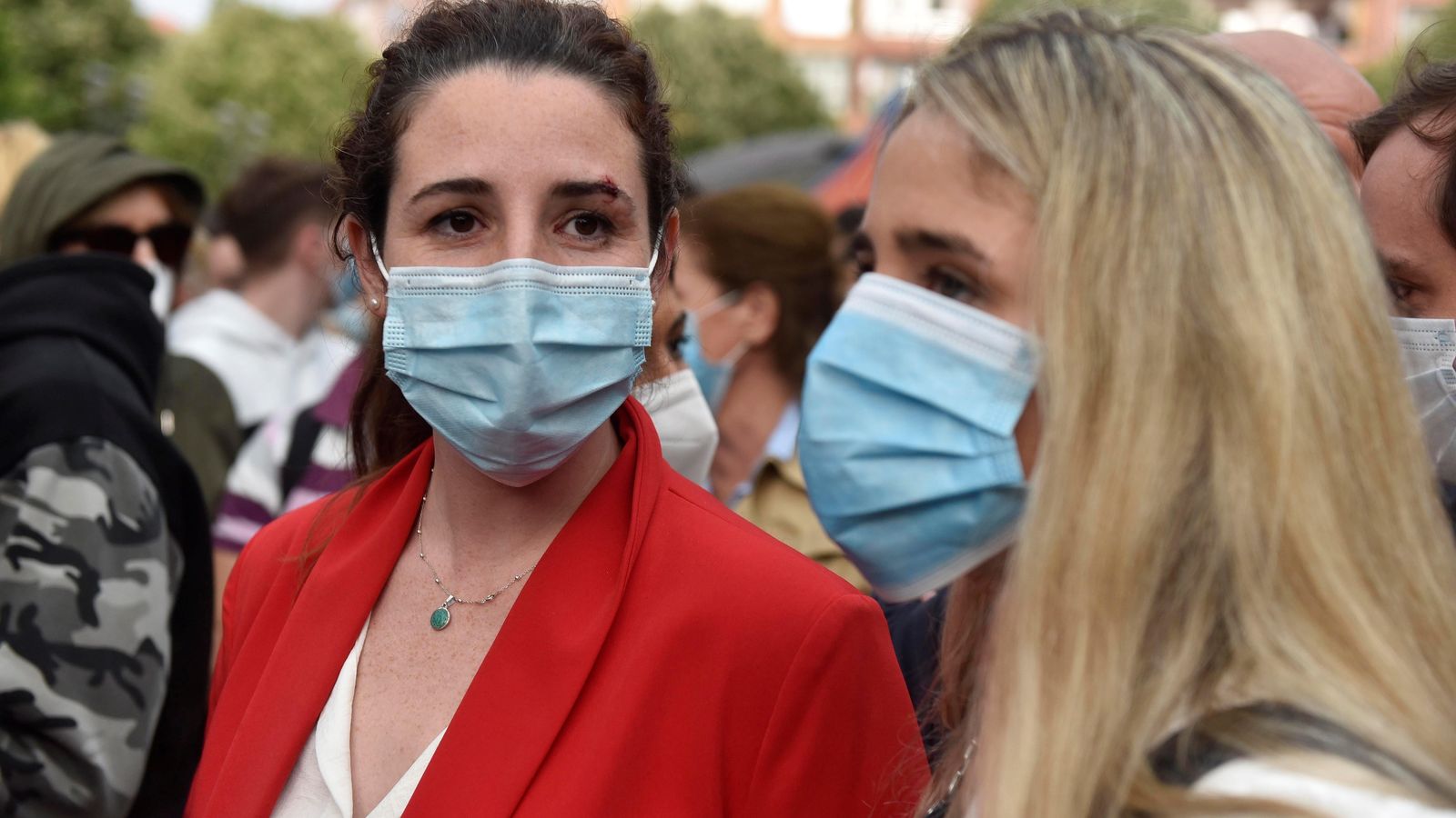 Rocio de Meer, con la ceja izquierda partida tras recibir la pedrada
