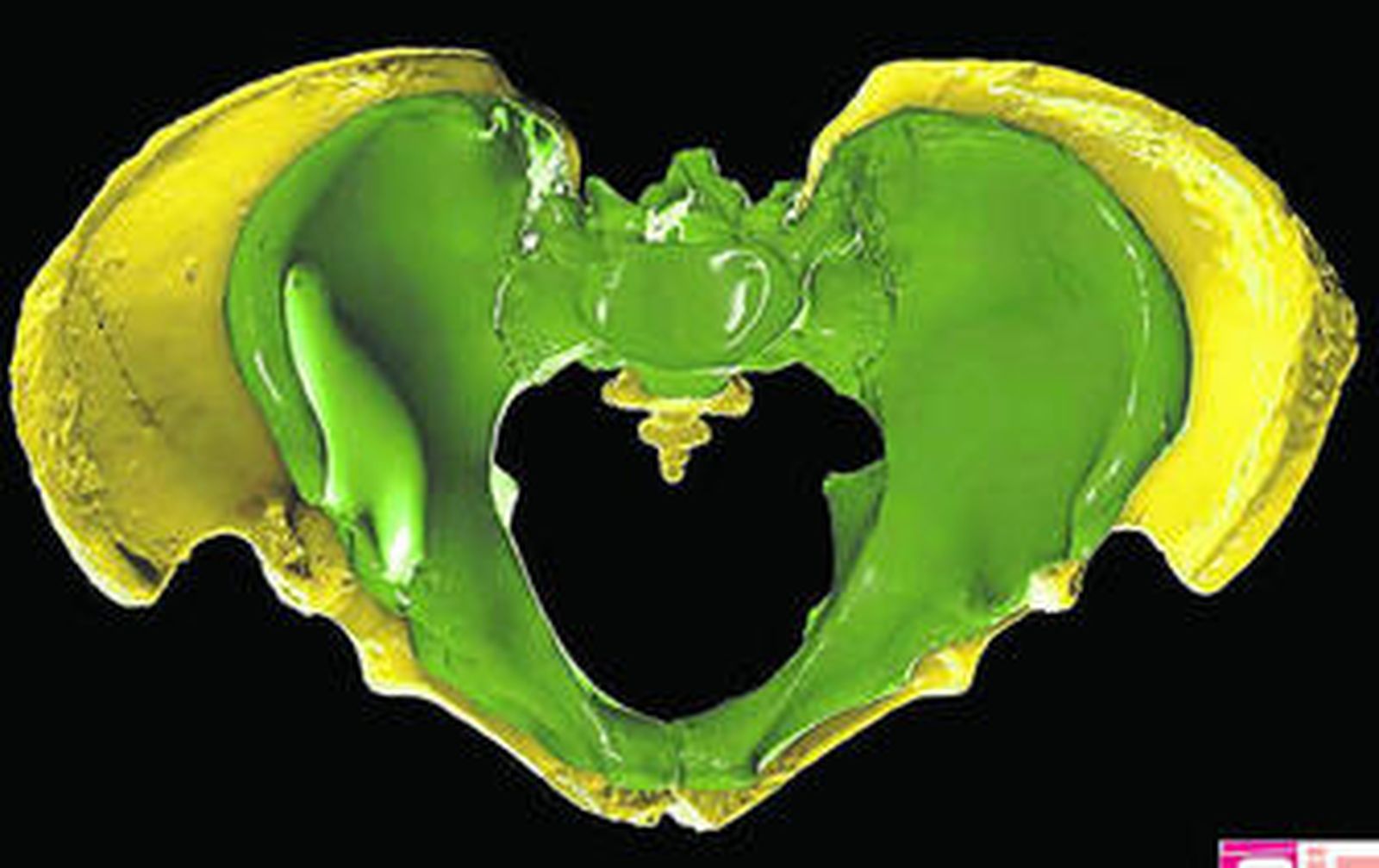 En la foto, pelvis de la Sima de los Huesos.