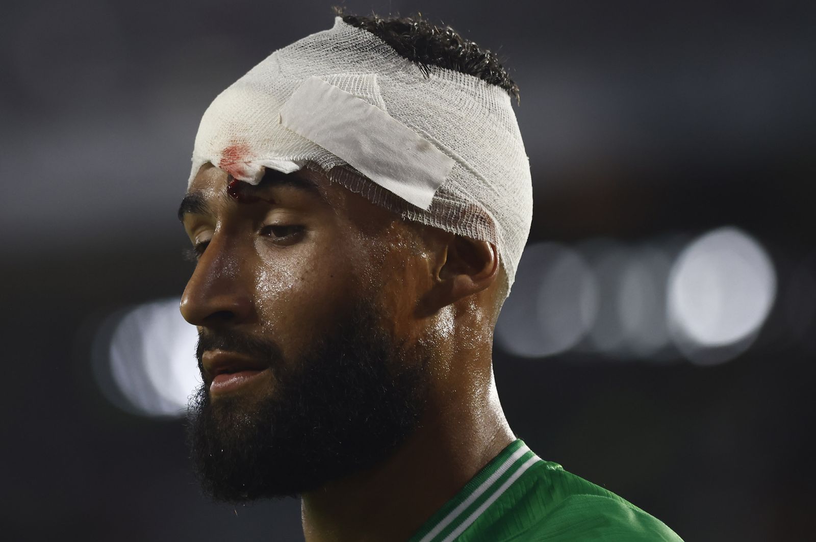 Fekir, con la brecha en la cabeza que sufrió en una fricción con Espino.