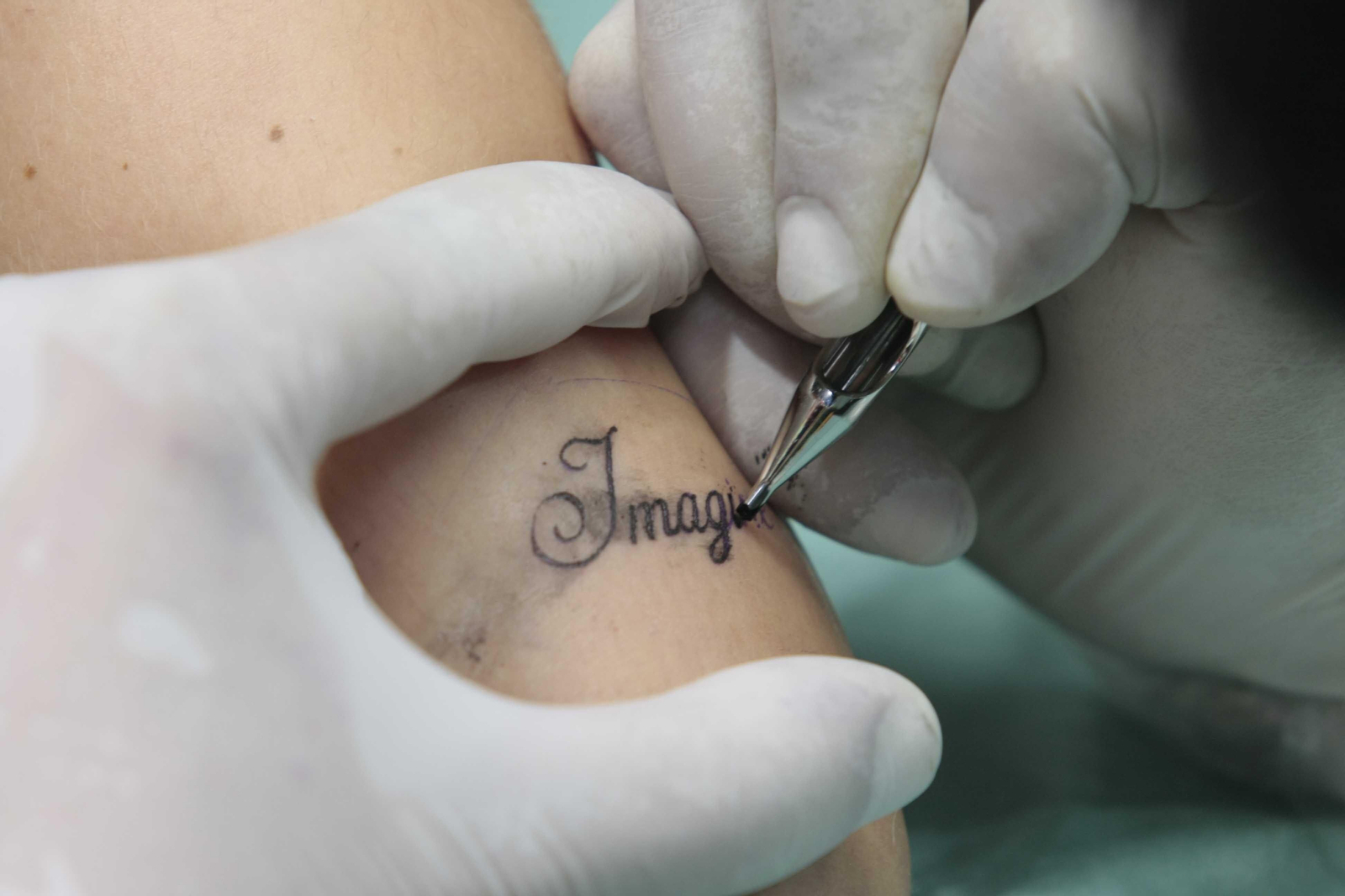 En fechas próximas a San Valentín, aumenta la demanda para eliminar tatuajes de nombres de exparejas.