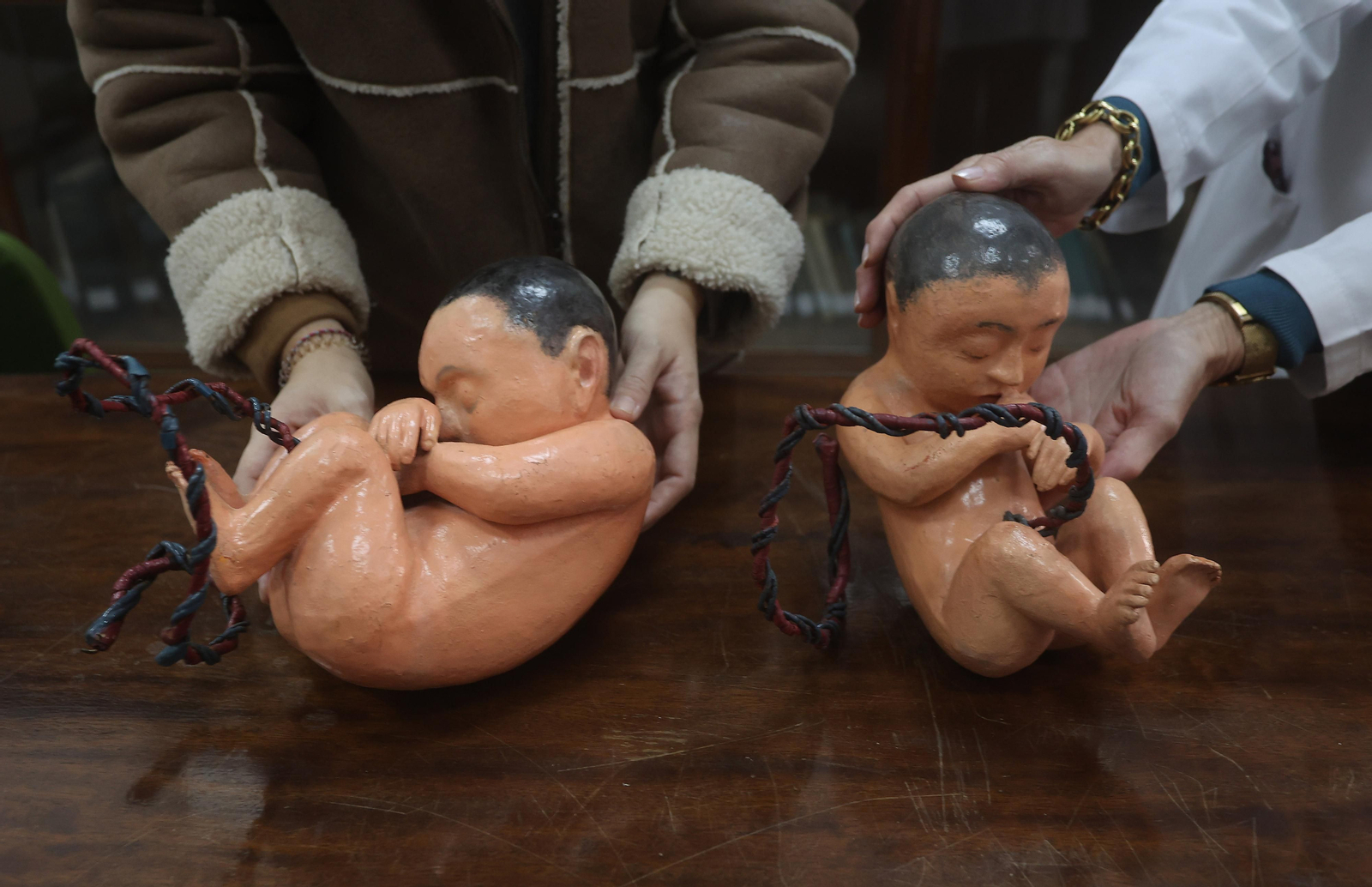 Restauración de esculturas anatómicas usadas con fines docentes entre el siglo XVIII y el XX en la Facultad de Medicina de la US