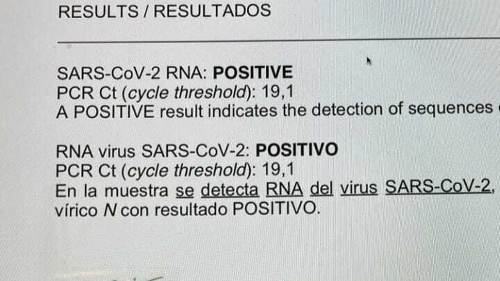 El positivo de Carlos Herrera