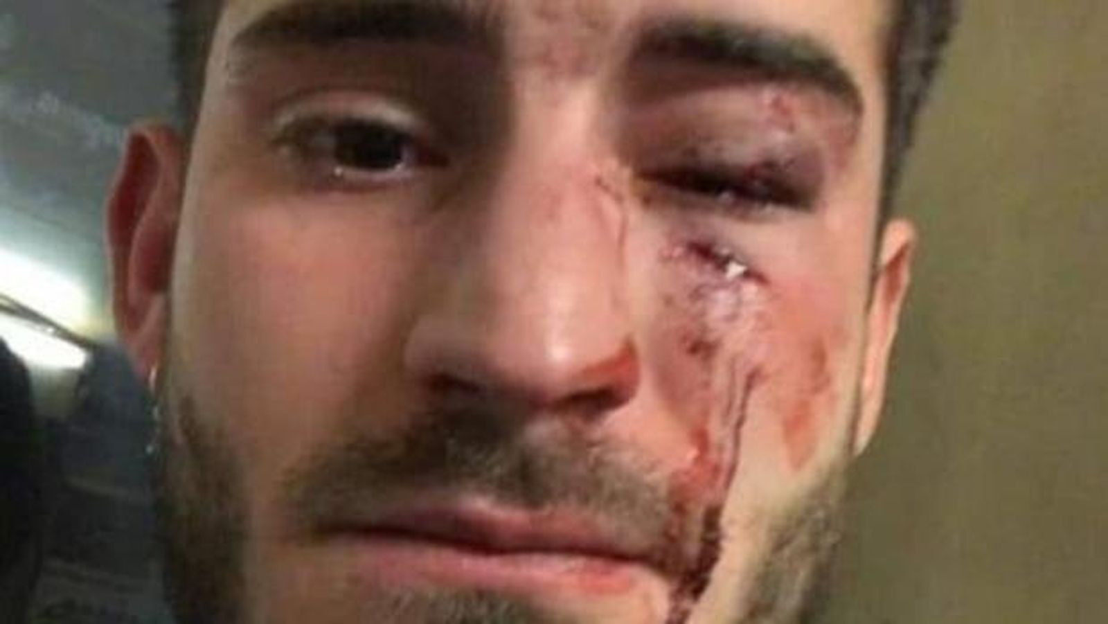 La imagen difundida del agredido.