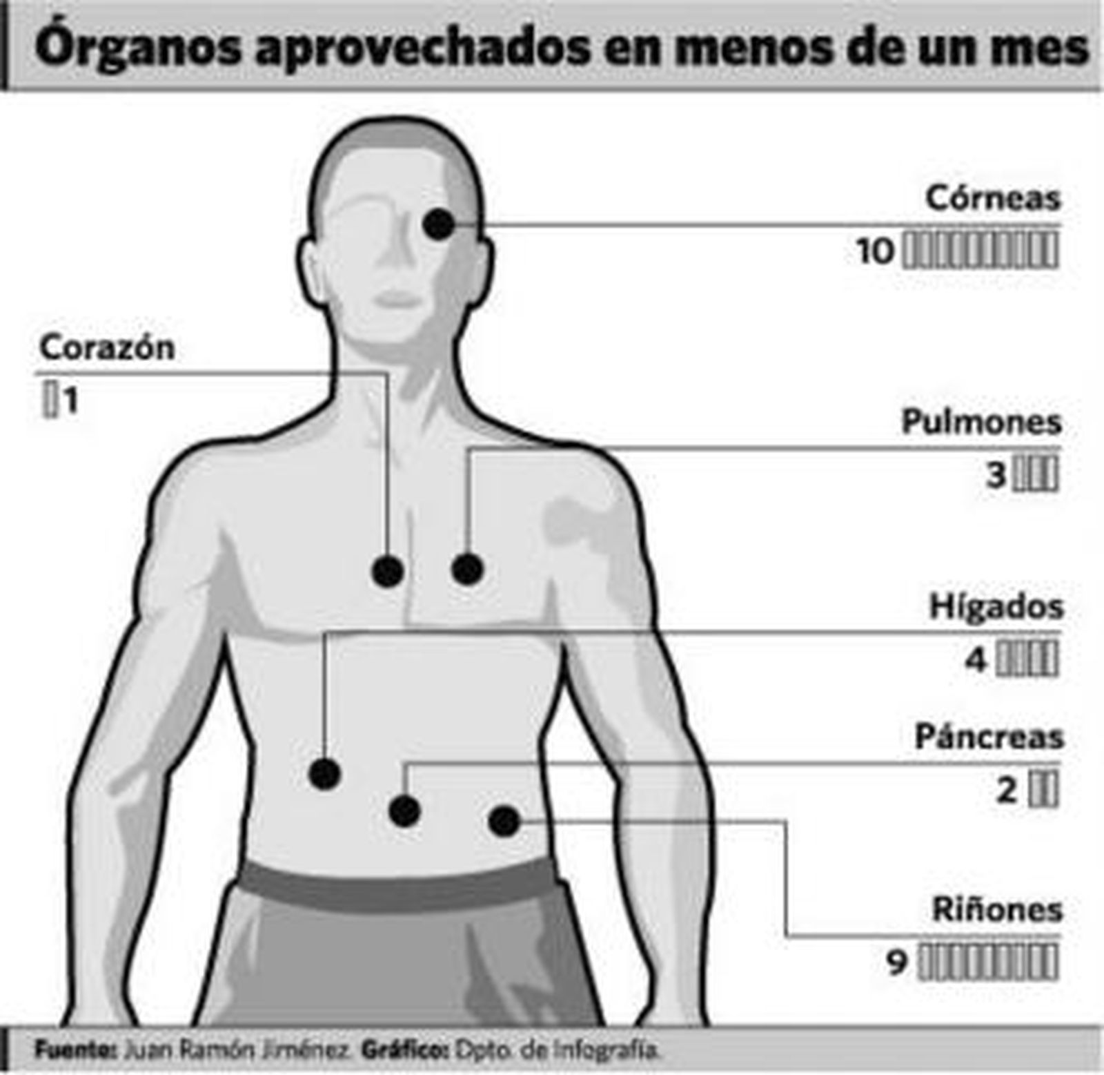 Imagen de una intervención de trasplante hepático.