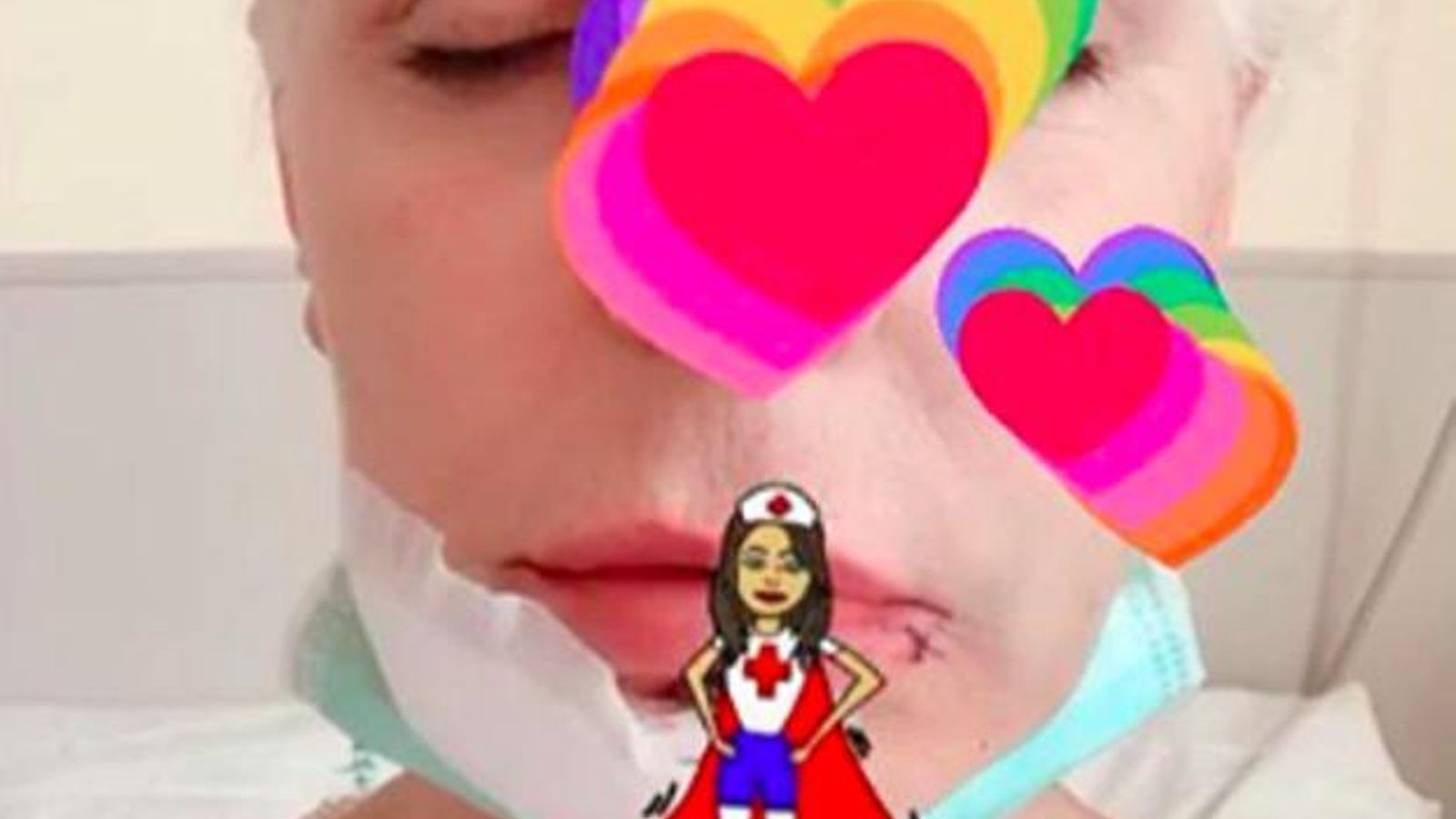 Imagen que Antonia Dell'Atte ha compartido en el hospital, con la mandíbula llena de puntos.