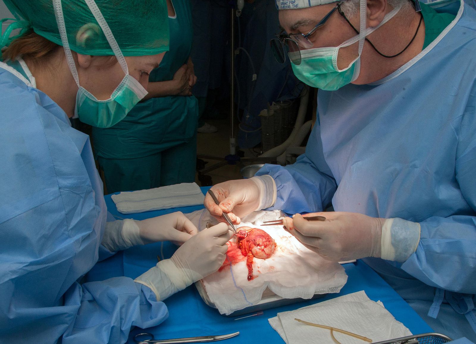 Imagen de archivo de una operación de donación de órganos.