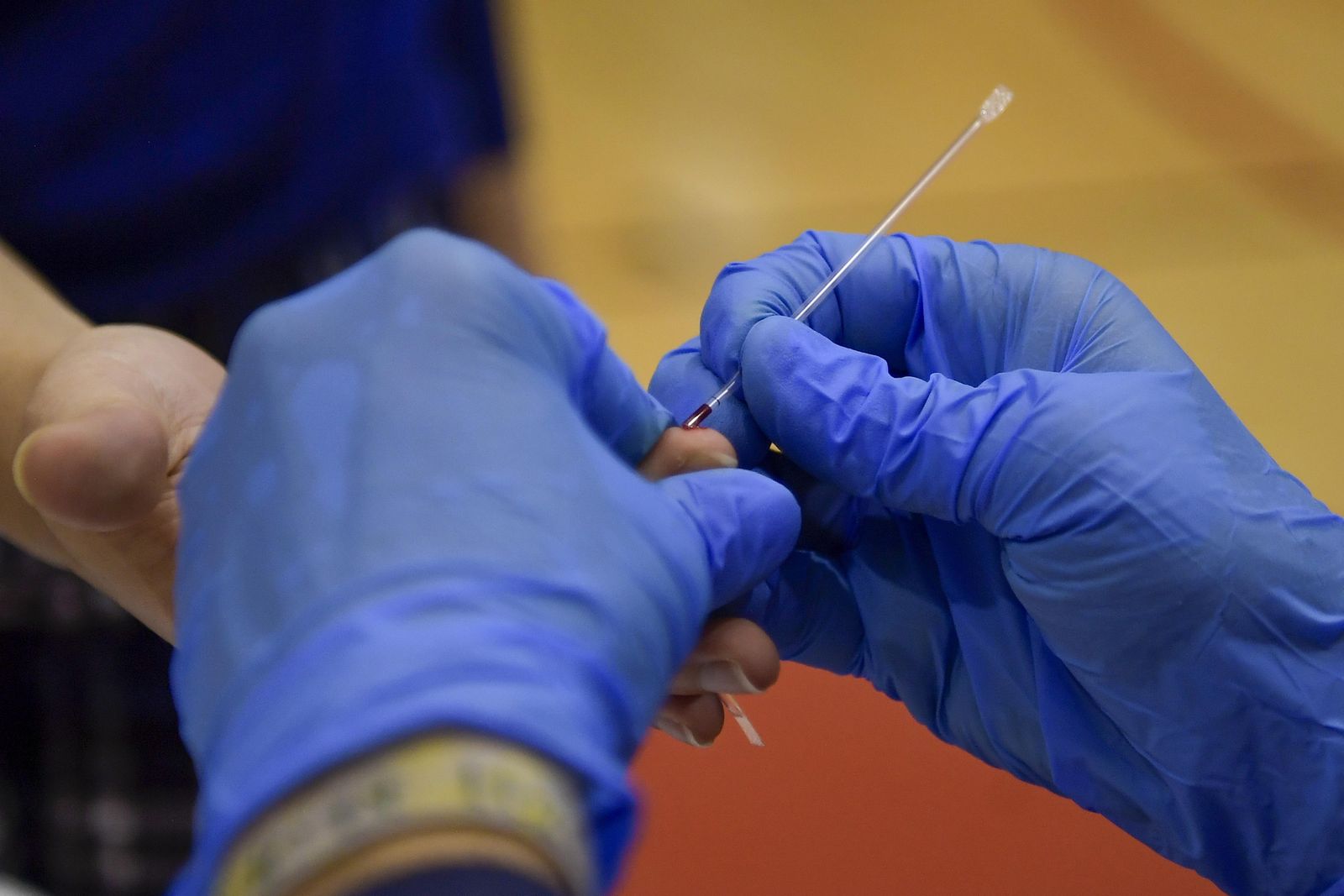 El test serológico determina si nuestro organismo cuenta con anticuerpos y de qué tipo son