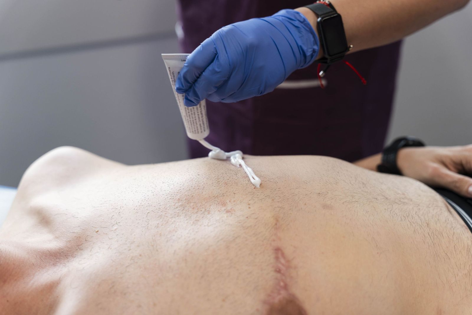 Un tratamiento de micropigmentación por mastectomía en un hombre, en imágenes