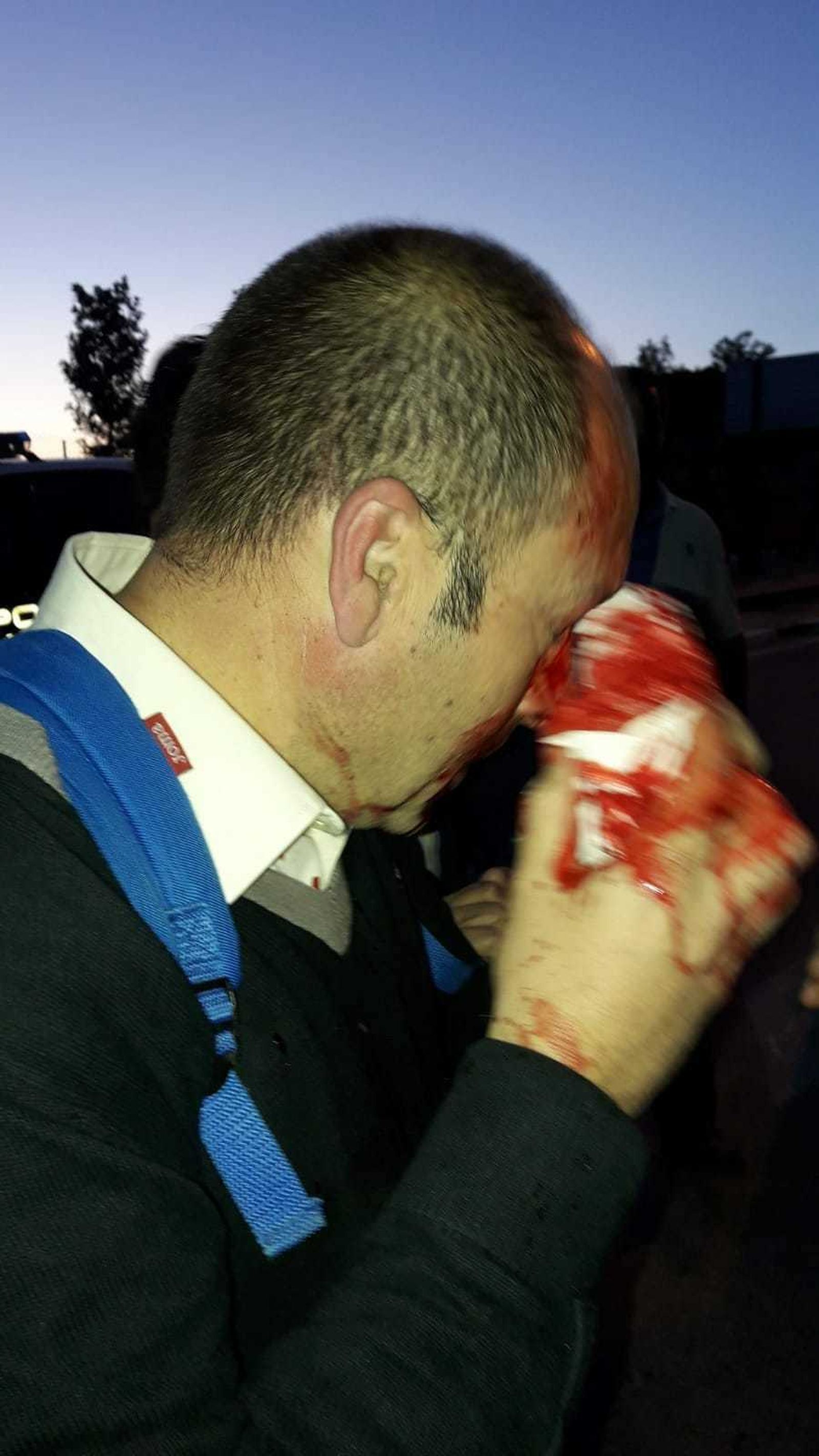 Uno de los heridos durante el altercado.