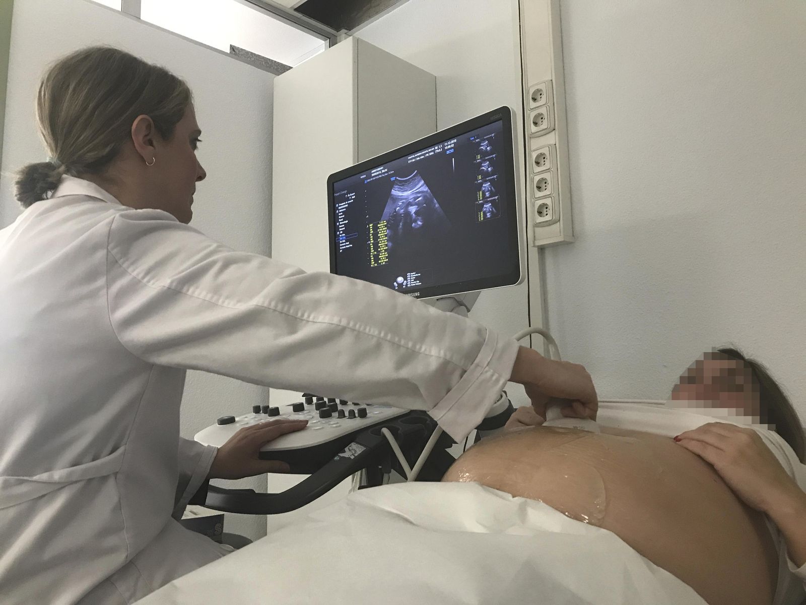 Una profesional realiza una ecografía a una embarazada.