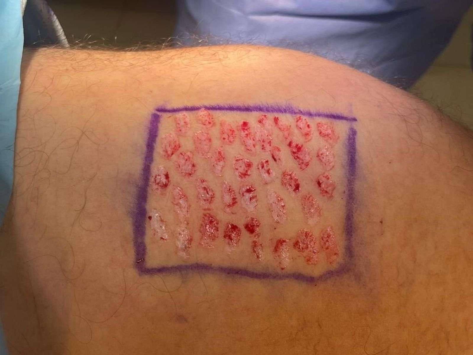 Resultado de la operación con la técnica aprendida.