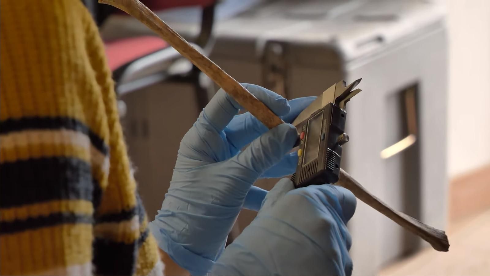 Medición de un hueso