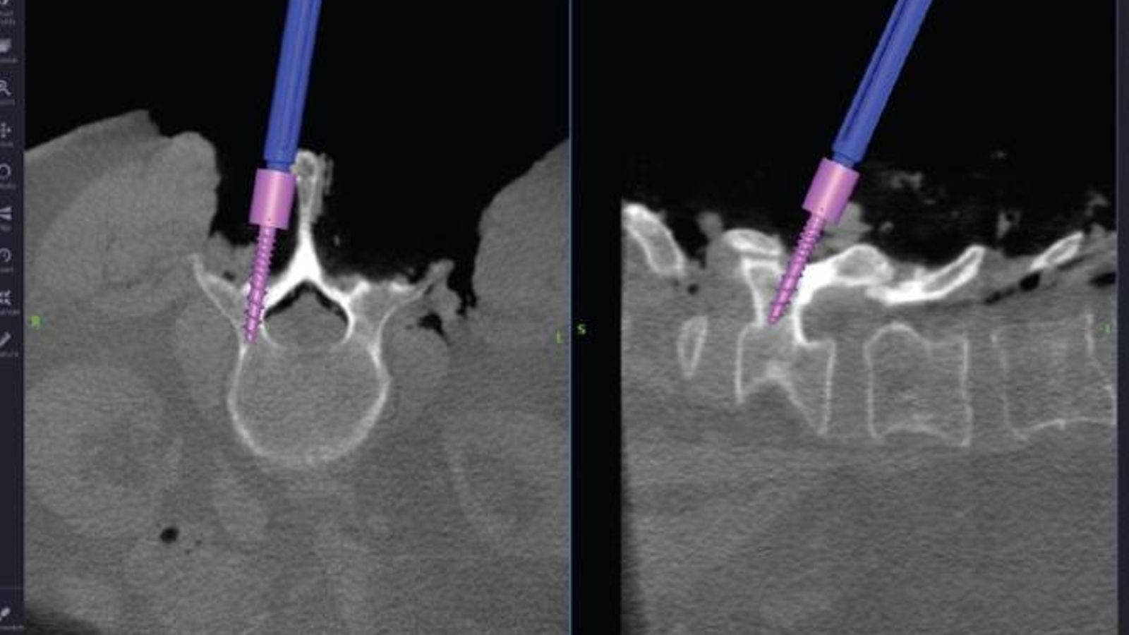 Imagen del neuronavegador