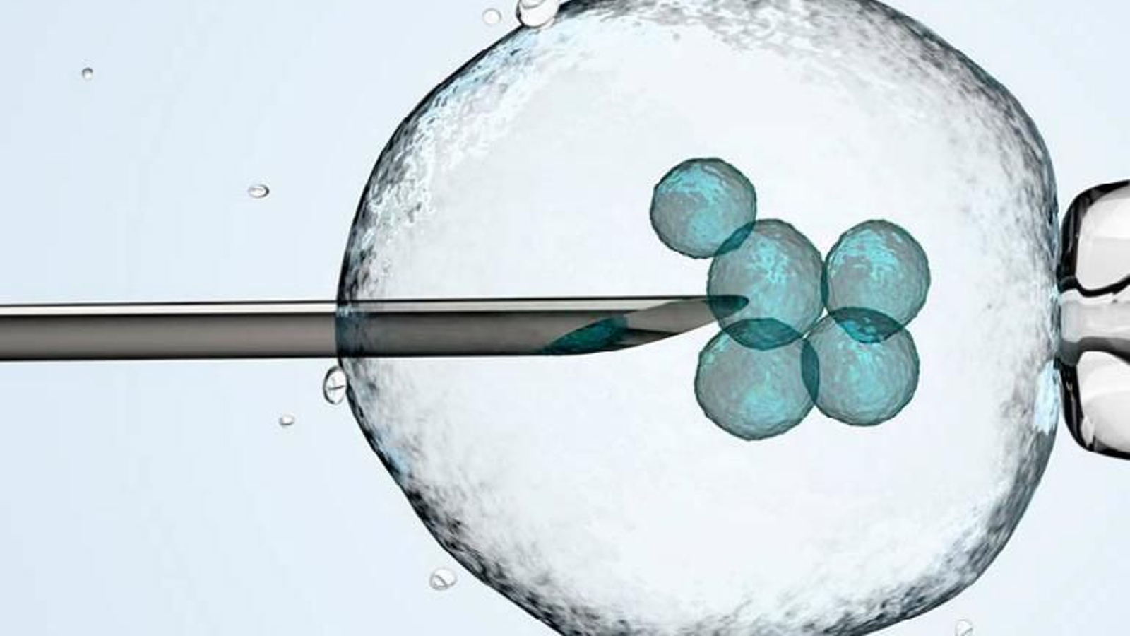 Conmoción en Países Bajos: un empleado de  una clínica de fertilidad con una enfermedad genética usó su semen en secreto durante años