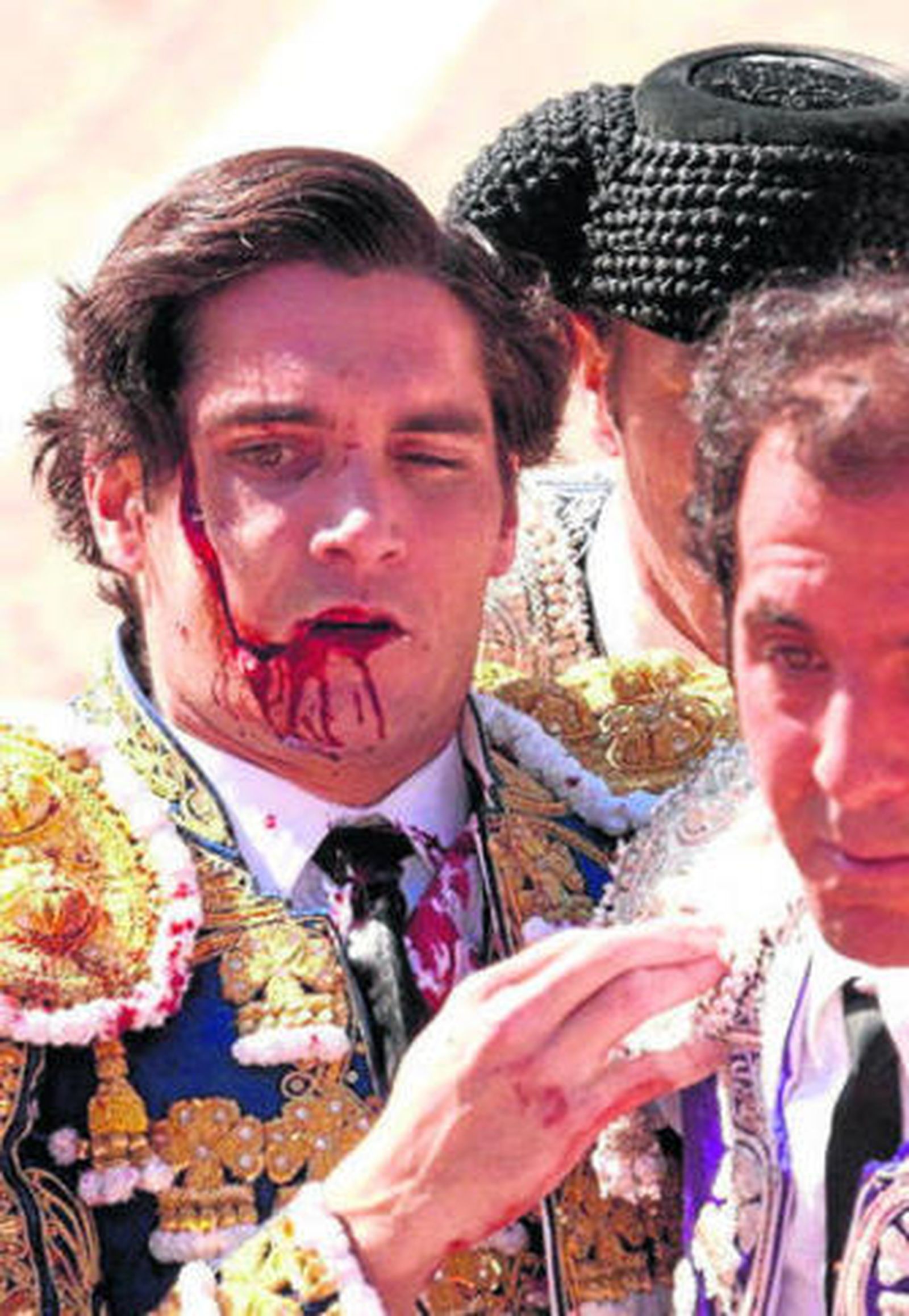 Ángel Teruel, gravemente herido en el rostro, camino de la enfermería.