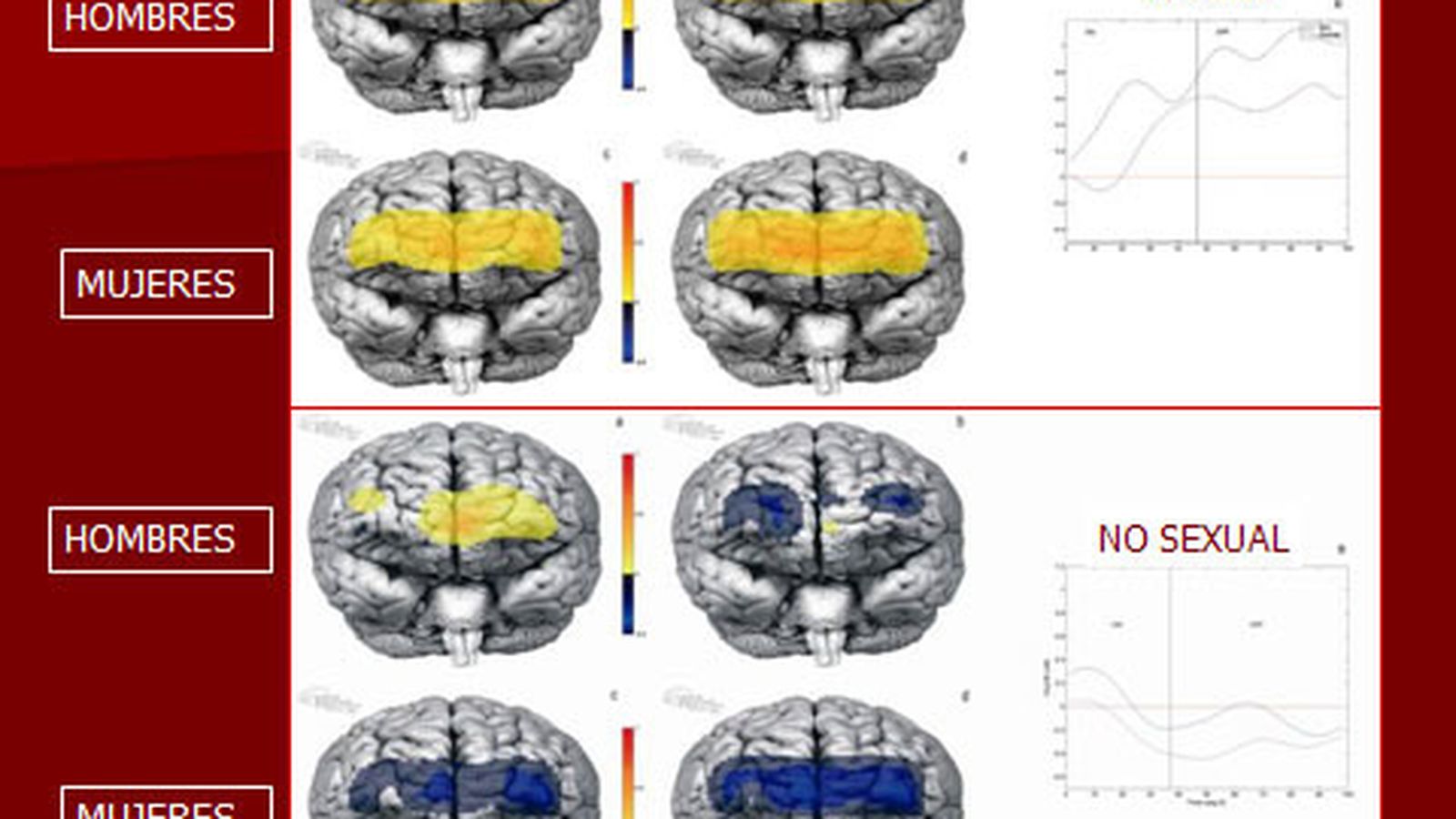 El cerebro humano ante imágenes con contenido sexual.