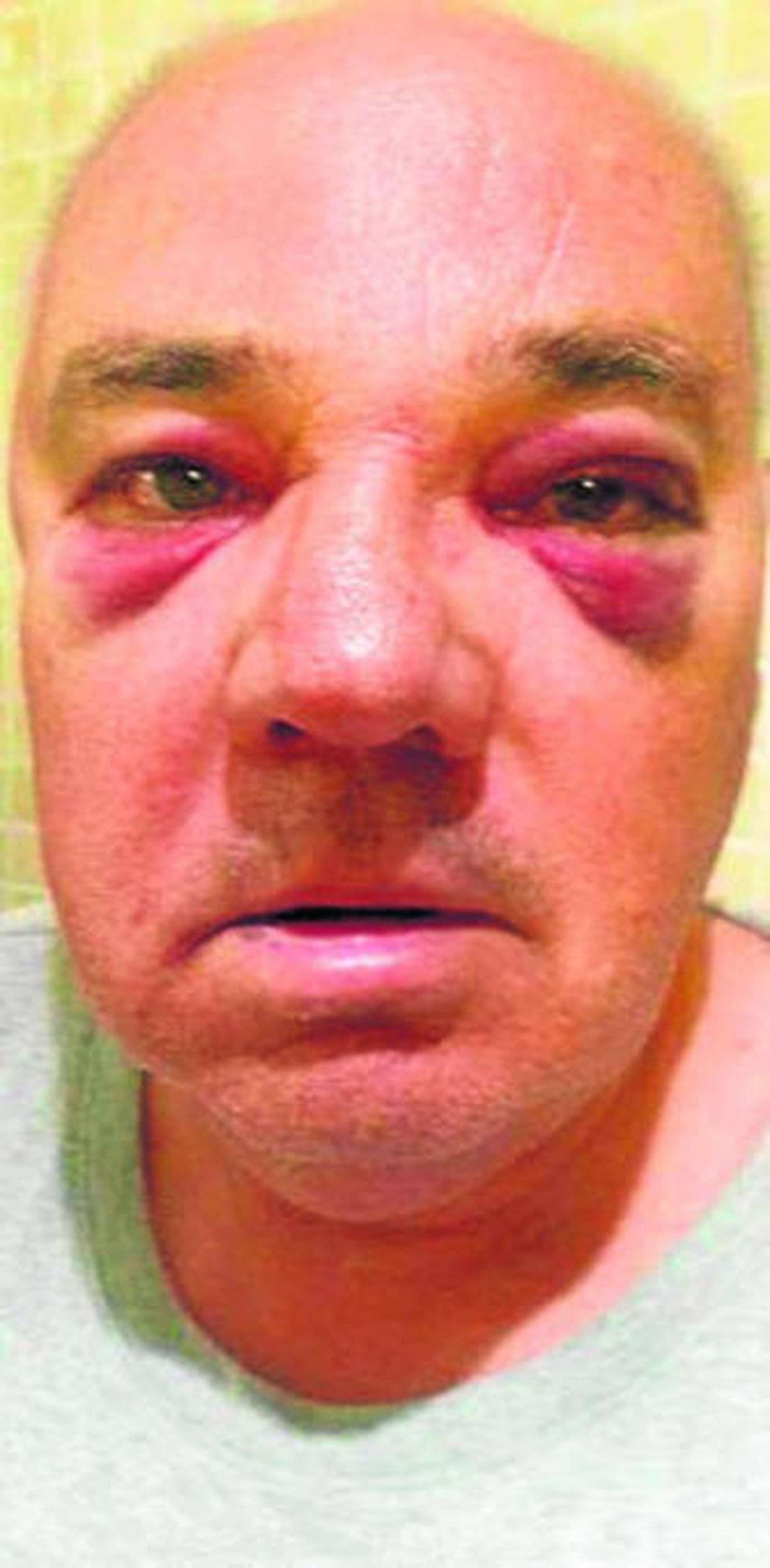 Manuel Vela, el taxista agredido.