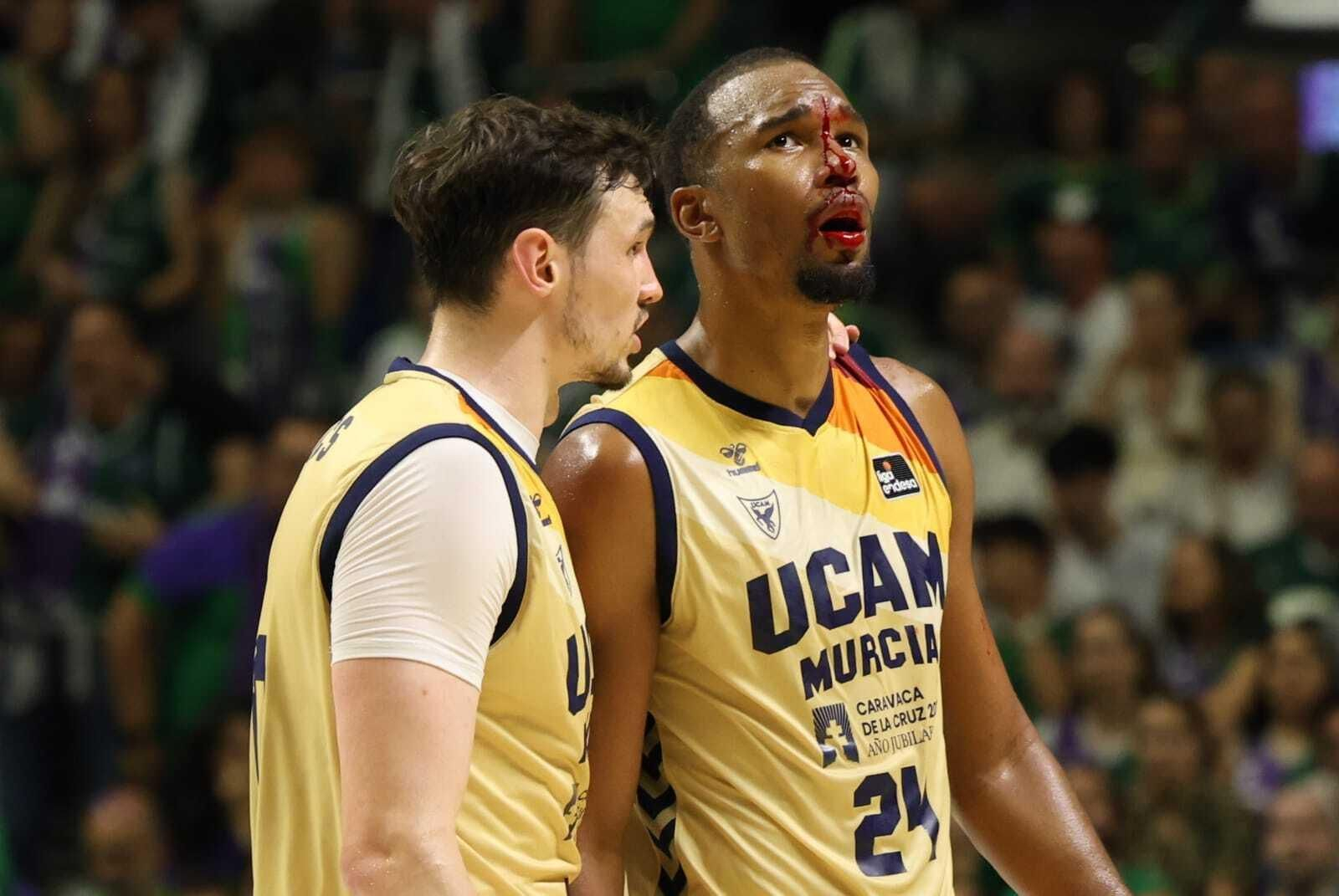 Fotos del Unicaja - UCAM Murcia