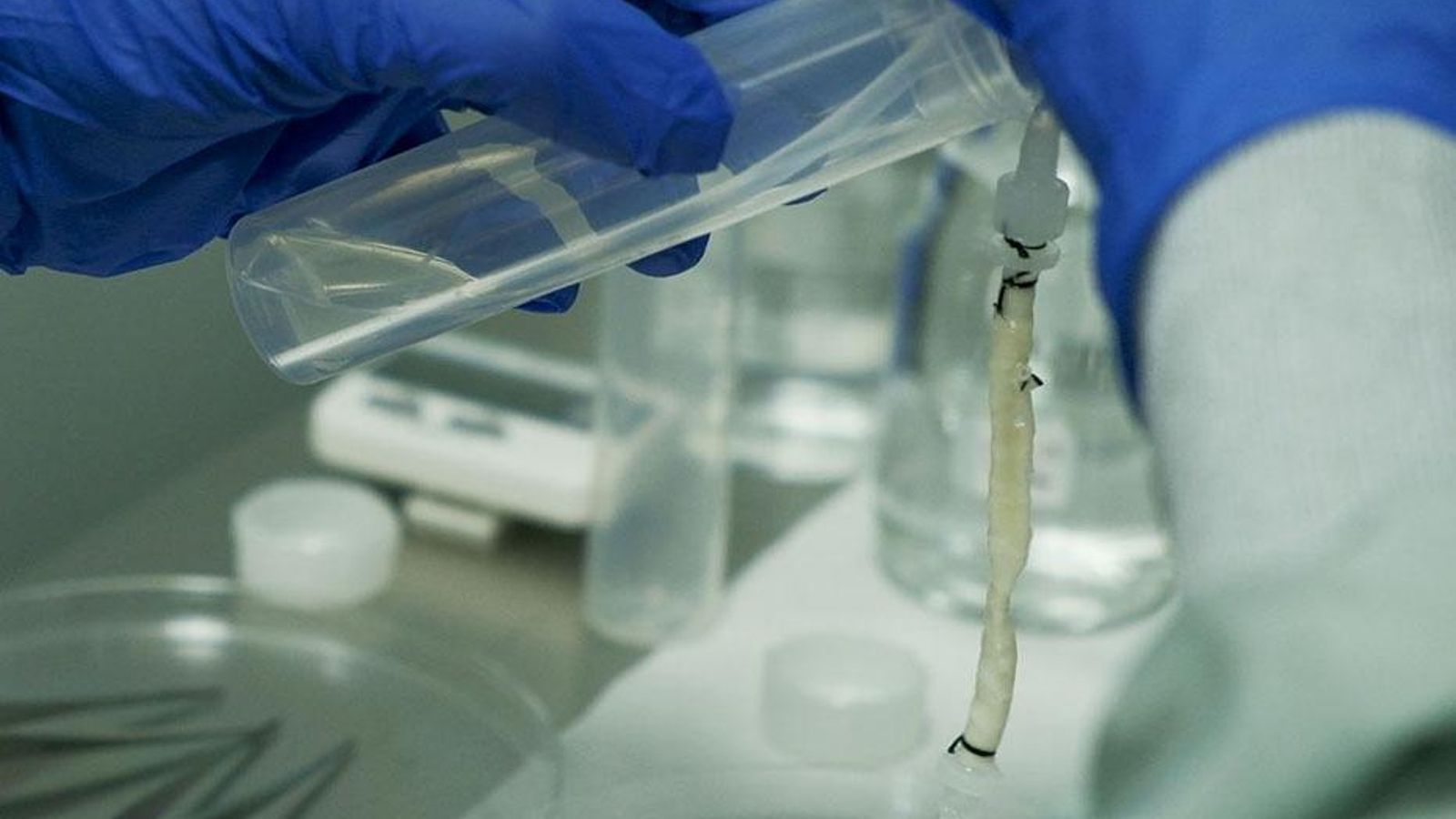 La vena se fabrica mediante ingeniería de tejidos.