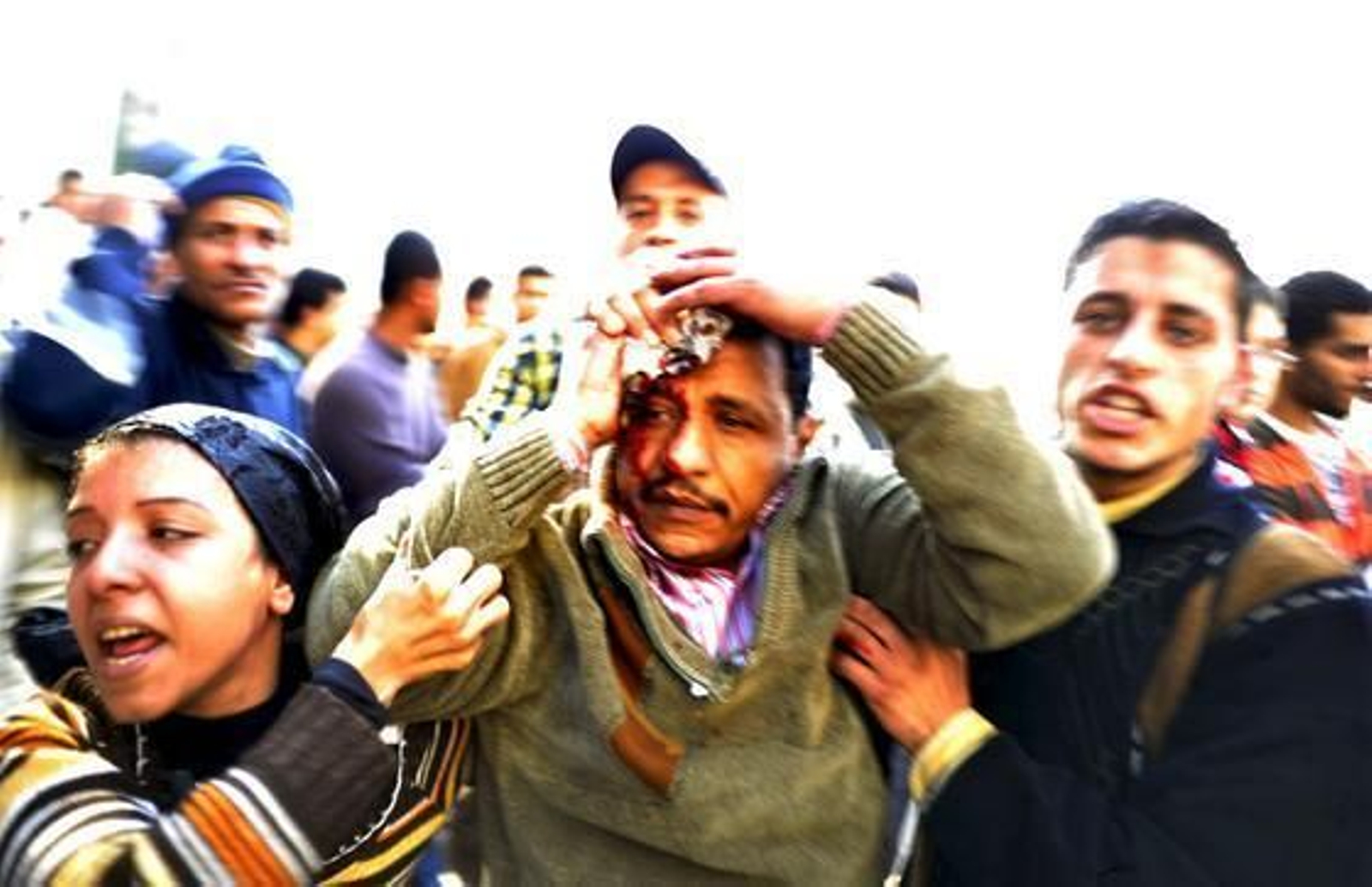 Un Egipcio se tapa una herida causada en los altercados  Foto: EFE/ Reuters