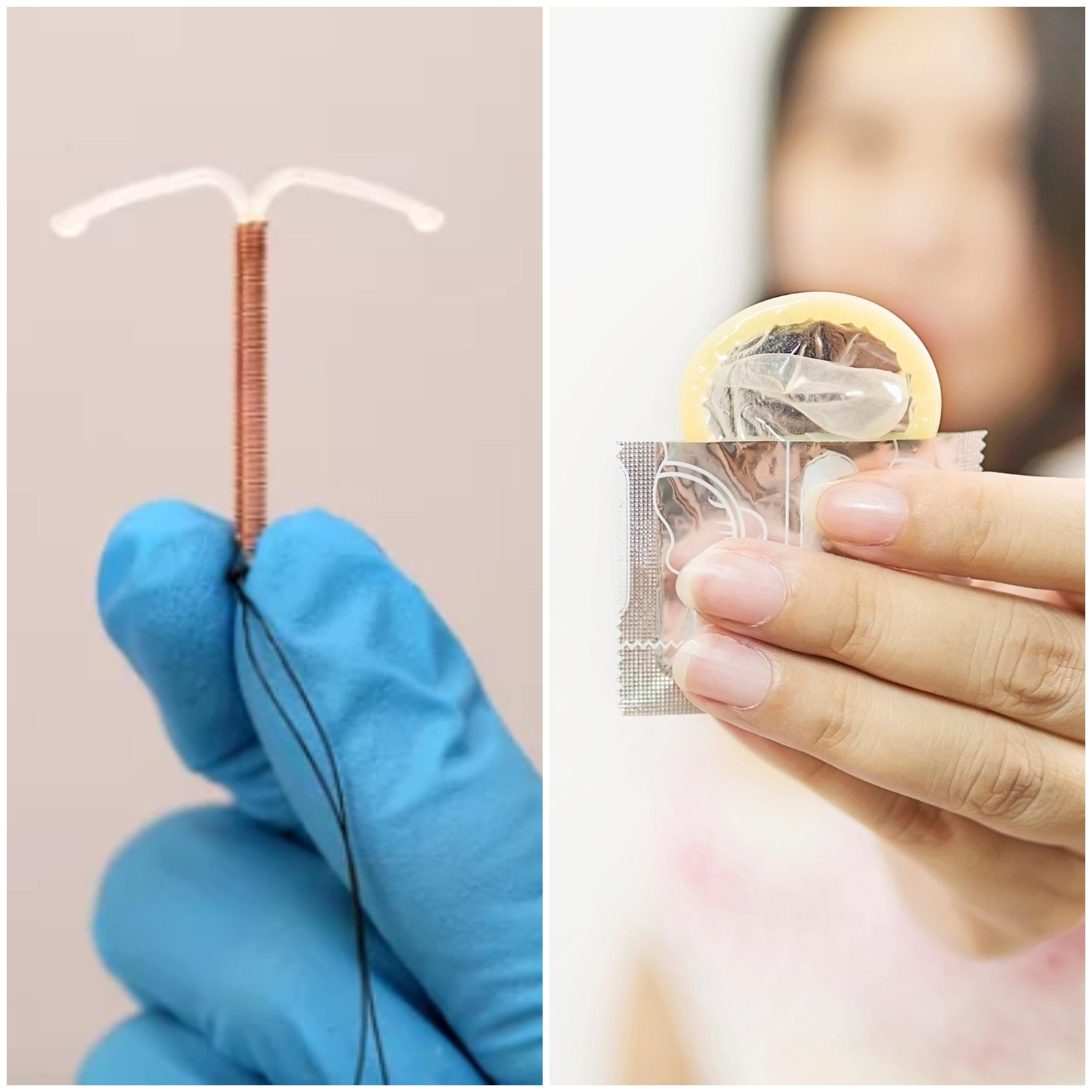 Ventajas de los preservativos como método anticonceptivo frente al DIU