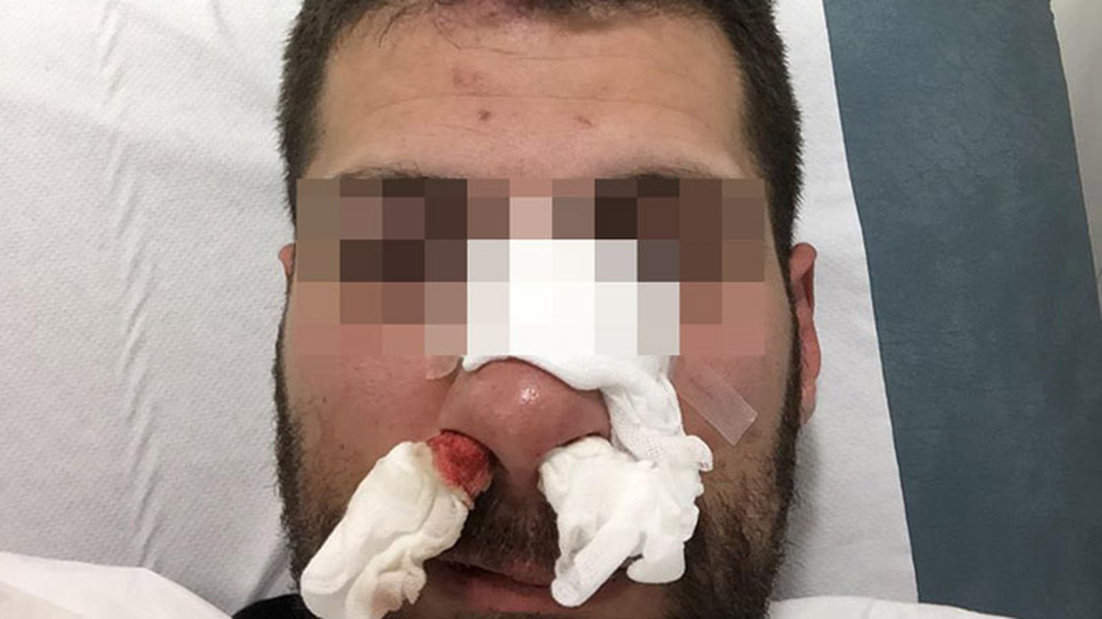 El agente de la UIP agredido en Melilla.