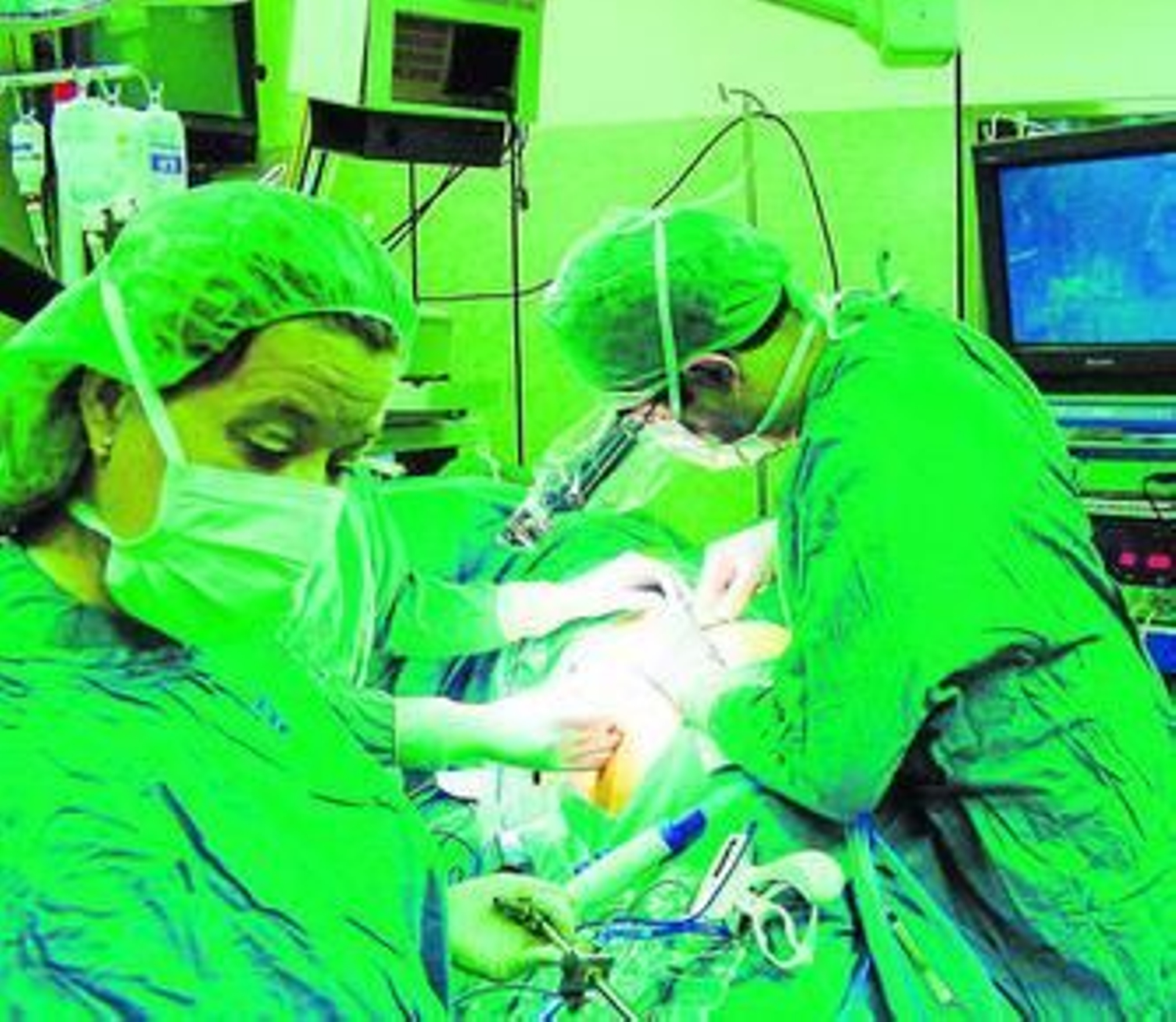 Intervención quirúrgica de trasplante de riñón.