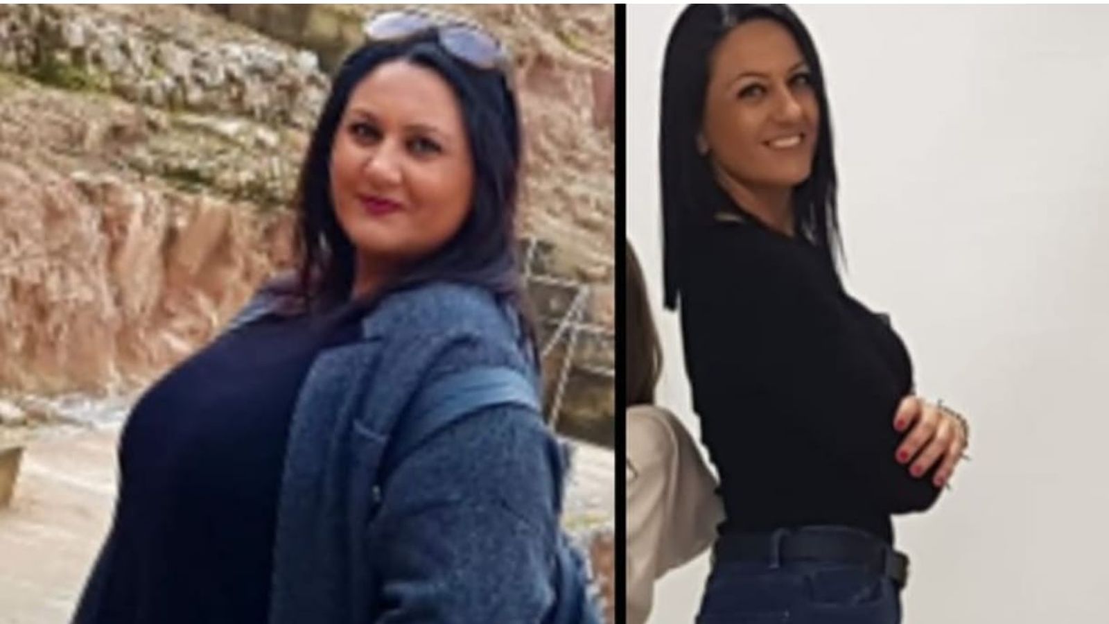 Minerva Martínez, antes y después de su operación para poner remedio a su obesidad