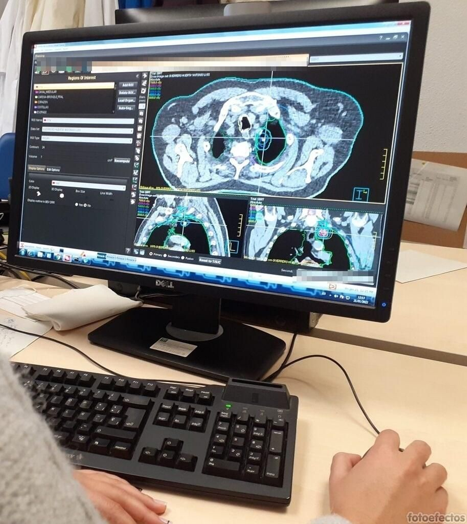 Una facultativa observa las imágenes tomadas por SBRT.