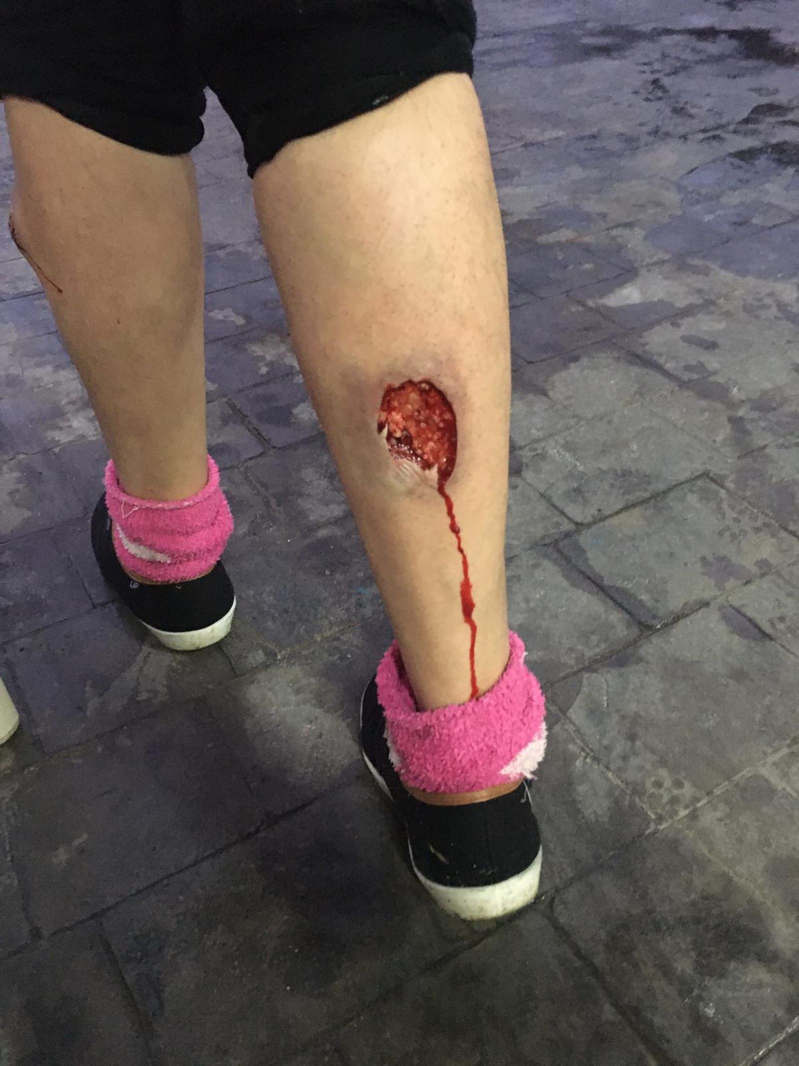 Estado en el que quedó una de las piernas de la víctima tras el ataque de los perros.