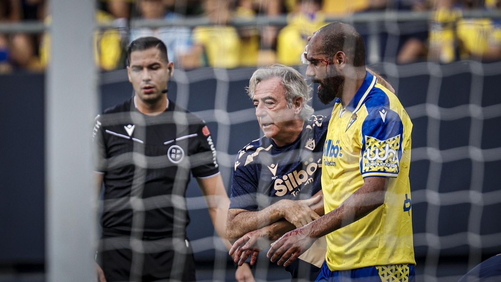 Búscate entre las fotos del partido de fútbol Cádiz CF - CD Tenerife de la Liga Hypermotion