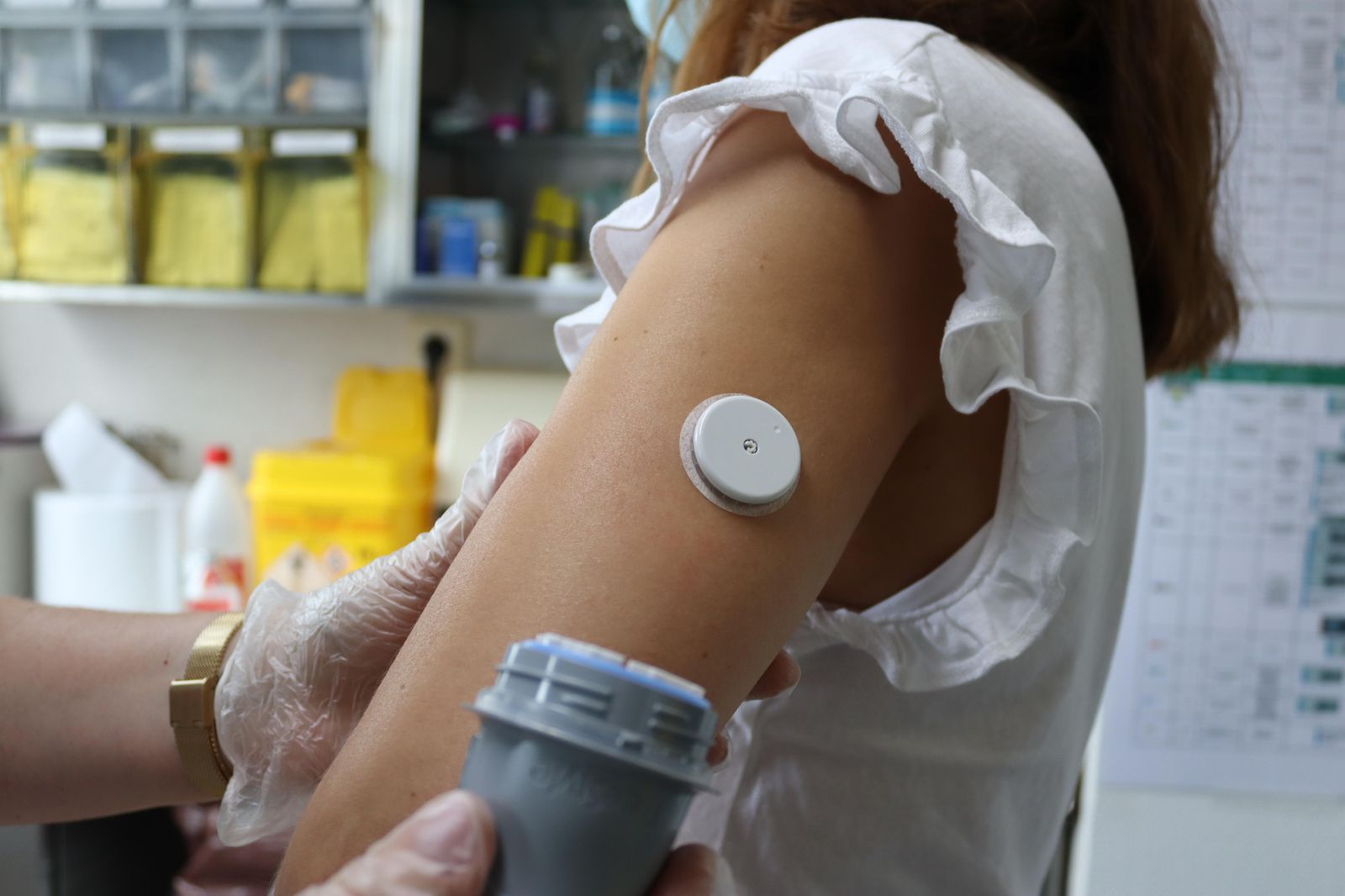 Una paciente que acaba de implantarse el dispositivo flahs en el brazo.