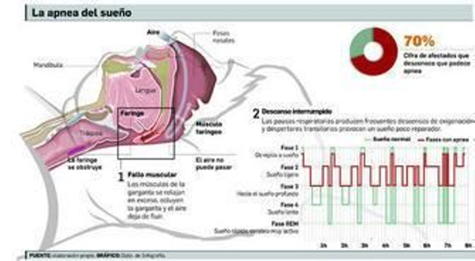 Sueños interrumpidosAPNEAS