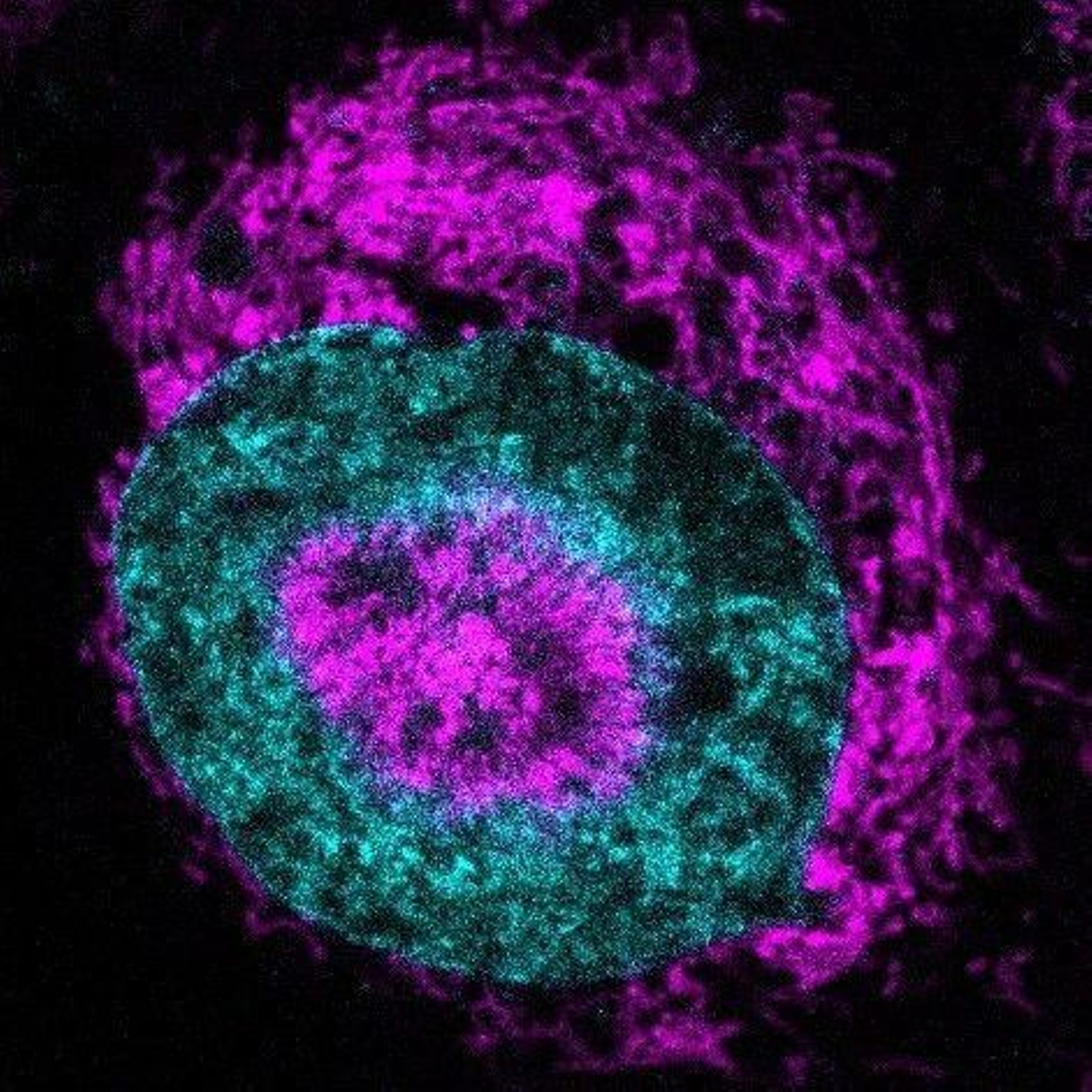 Célula cancerígena comprimida, en la que se pueden ver las mitocondrias (en magenta) acumulándose en la periferia nuclear (el núcleo se muestra en cian).