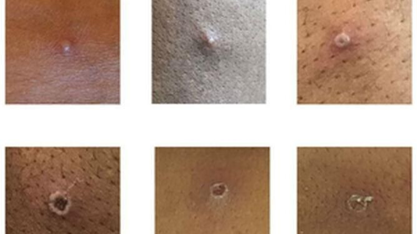 Los animales, responsables de la viruela del mono