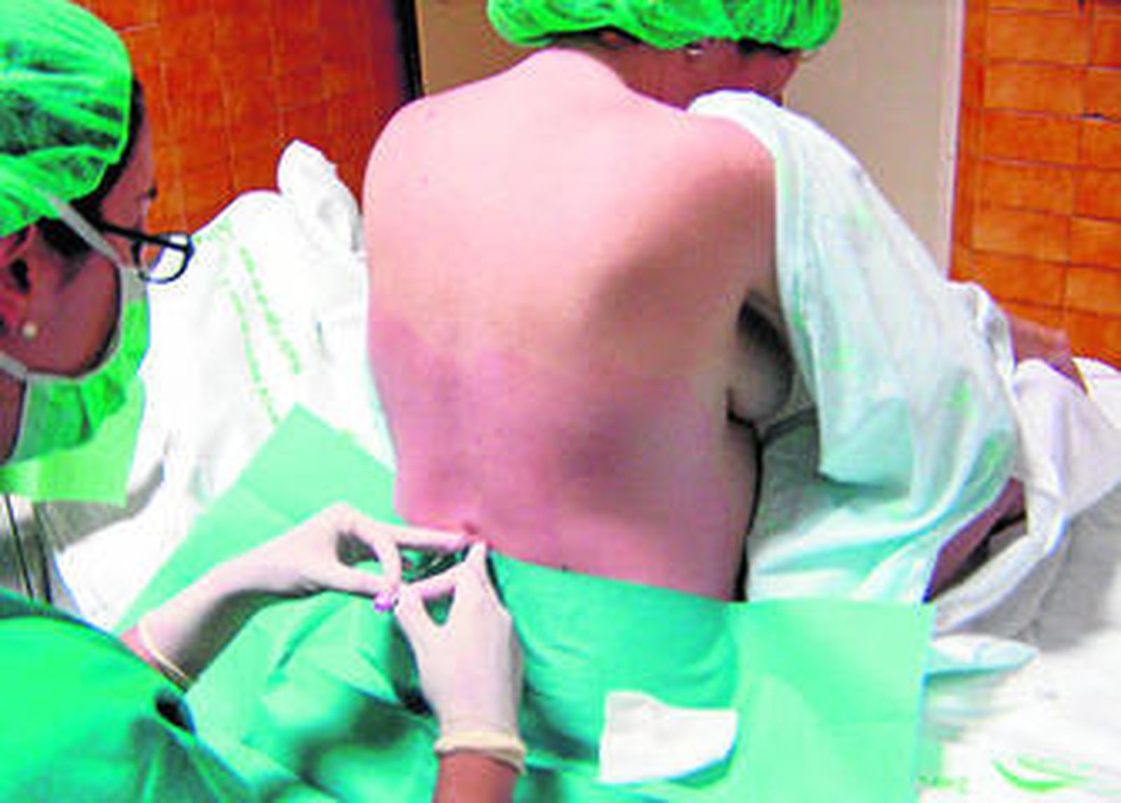 Una anestesista pone la epidural a una paciente a punto de dar a luz.